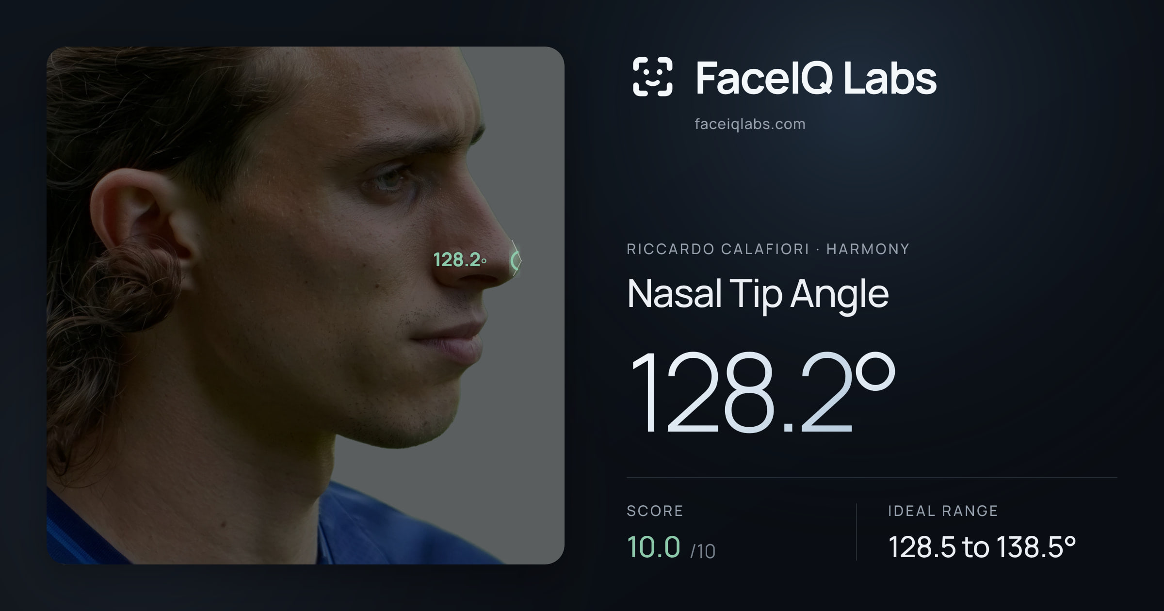 Riccardo Calafiori Nasal Tip Angle: 128.2°, drawn on the photo