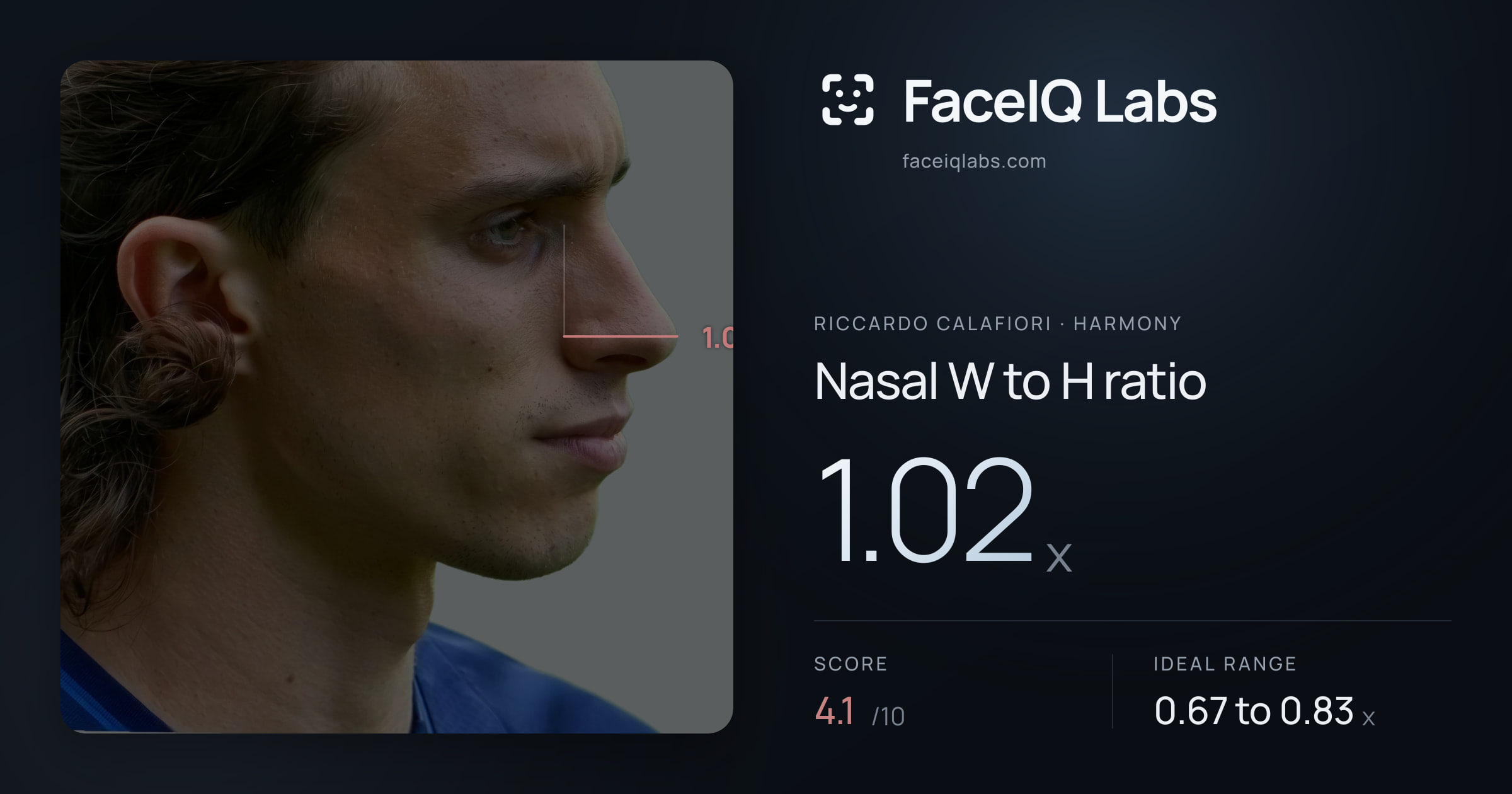 Riccardo Calafiori Nasal W to H ratio: 1.02x, drawn on the photo