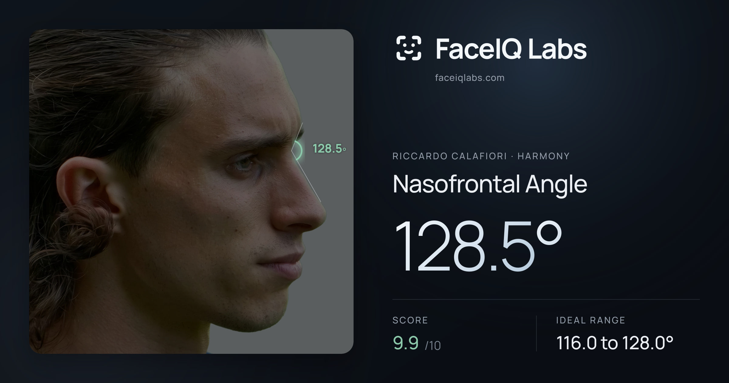 Riccardo Calafiori Nasofrontal Angle: 128.5°, drawn on the photo