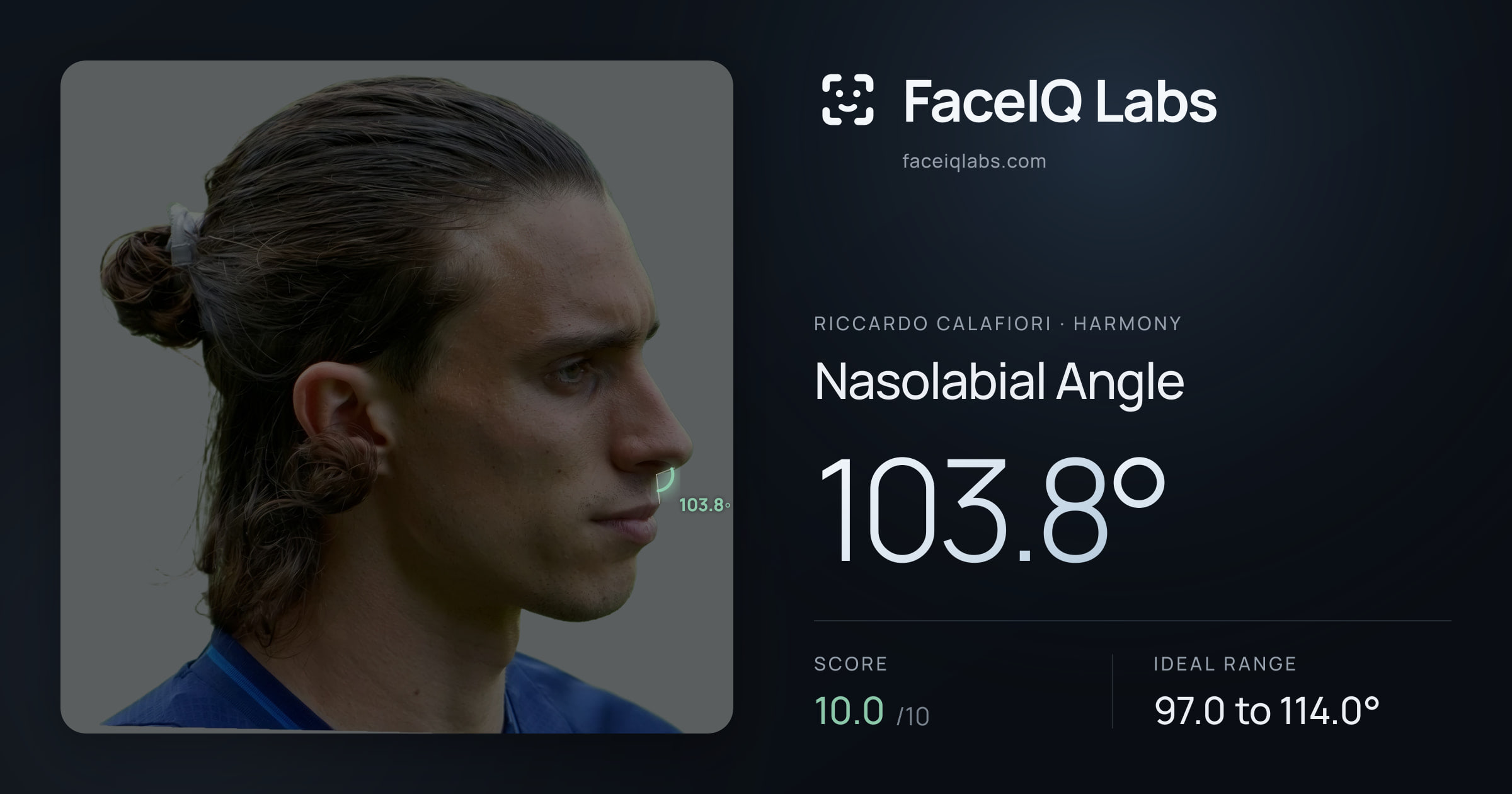 Riccardo Calafiori Nasolabial Angle: 103.8°, drawn on the photo
