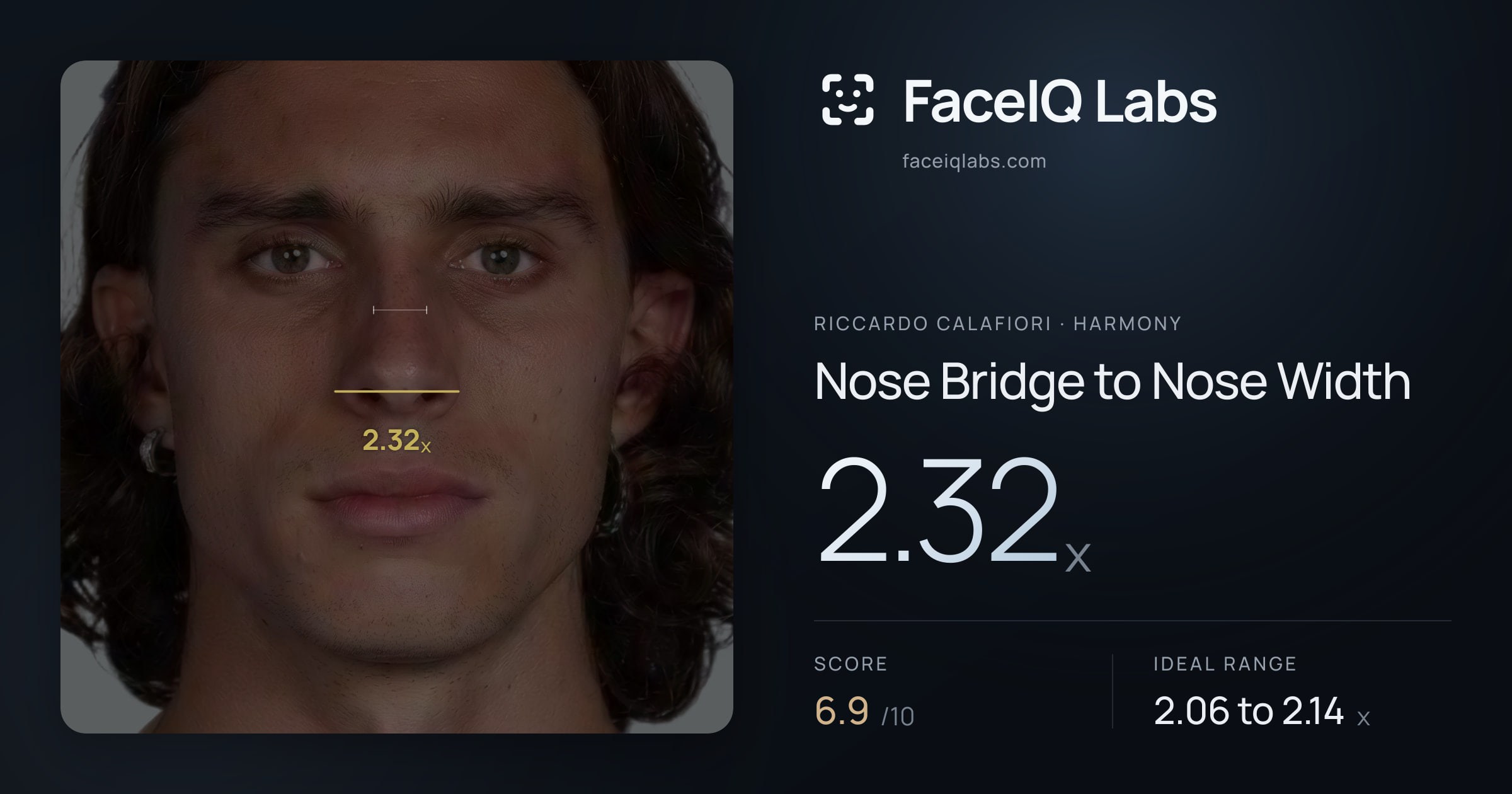 Riccardo Calafiori Nose Bridge to Nose Width: 2.32x, drawn on the photo