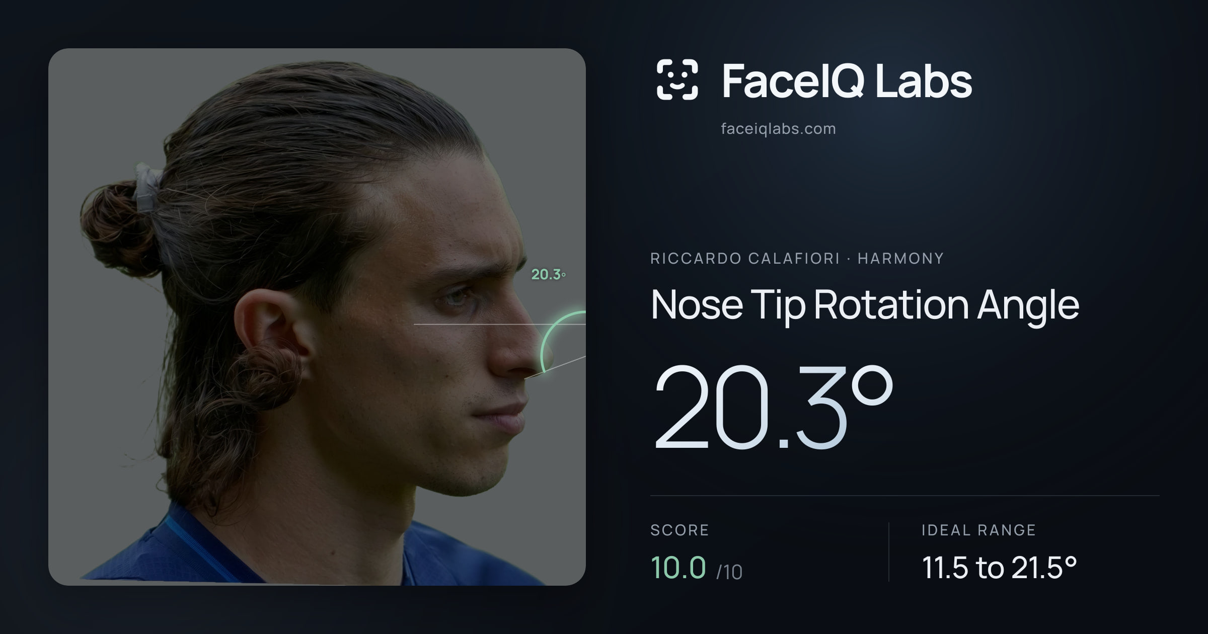 Riccardo Calafiori Nose Tip Rotation Angle: 20.3°, drawn on the photo
