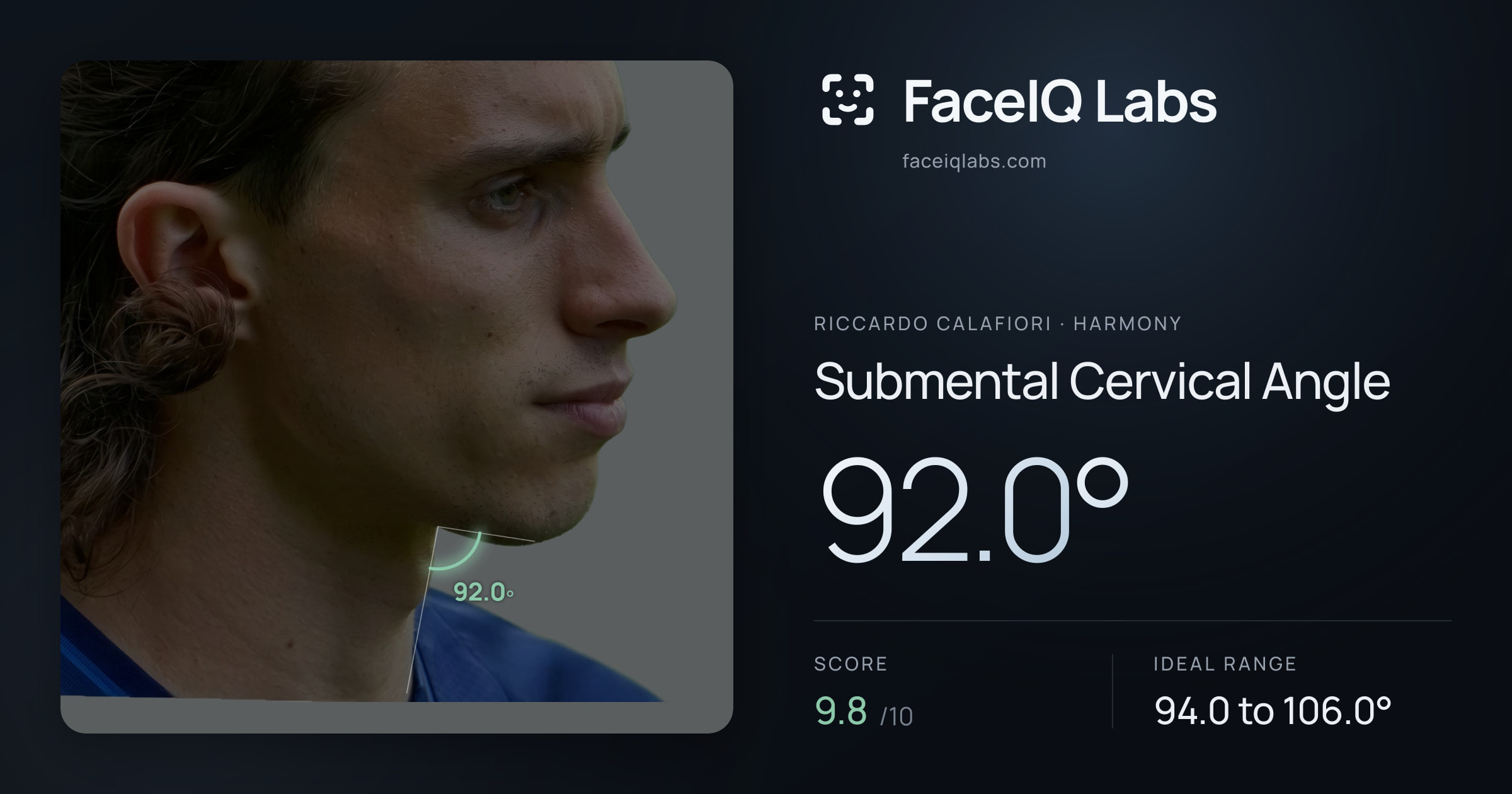 Riccardo Calafiori Submental Cervical Angle: 92.0°, drawn on the photo