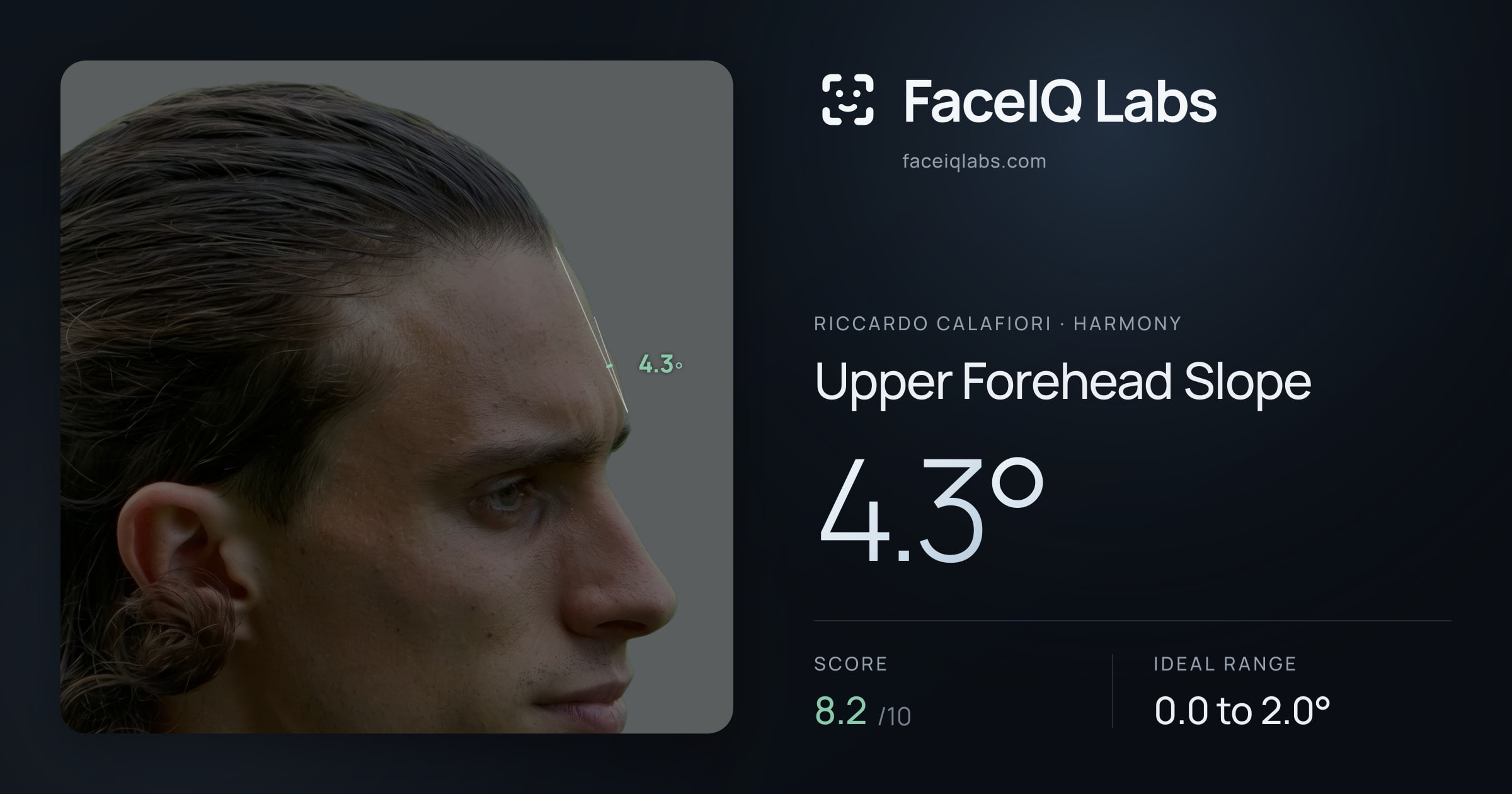 Riccardo Calafiori Upper Forehead Slope: 4.3°, drawn on the photo