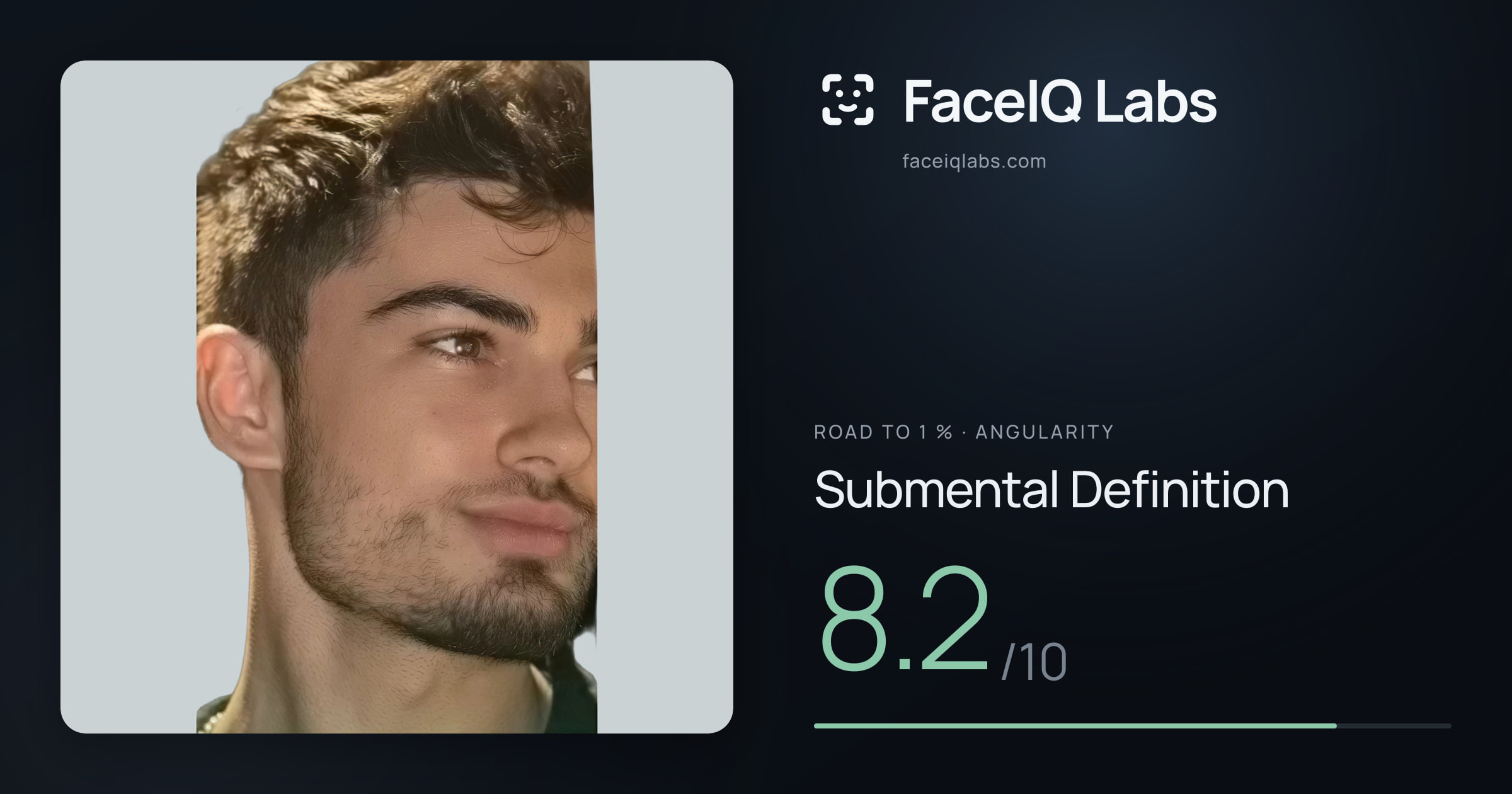 Road To 1 % Submental Definition: 8.2/10, drawn on the photo