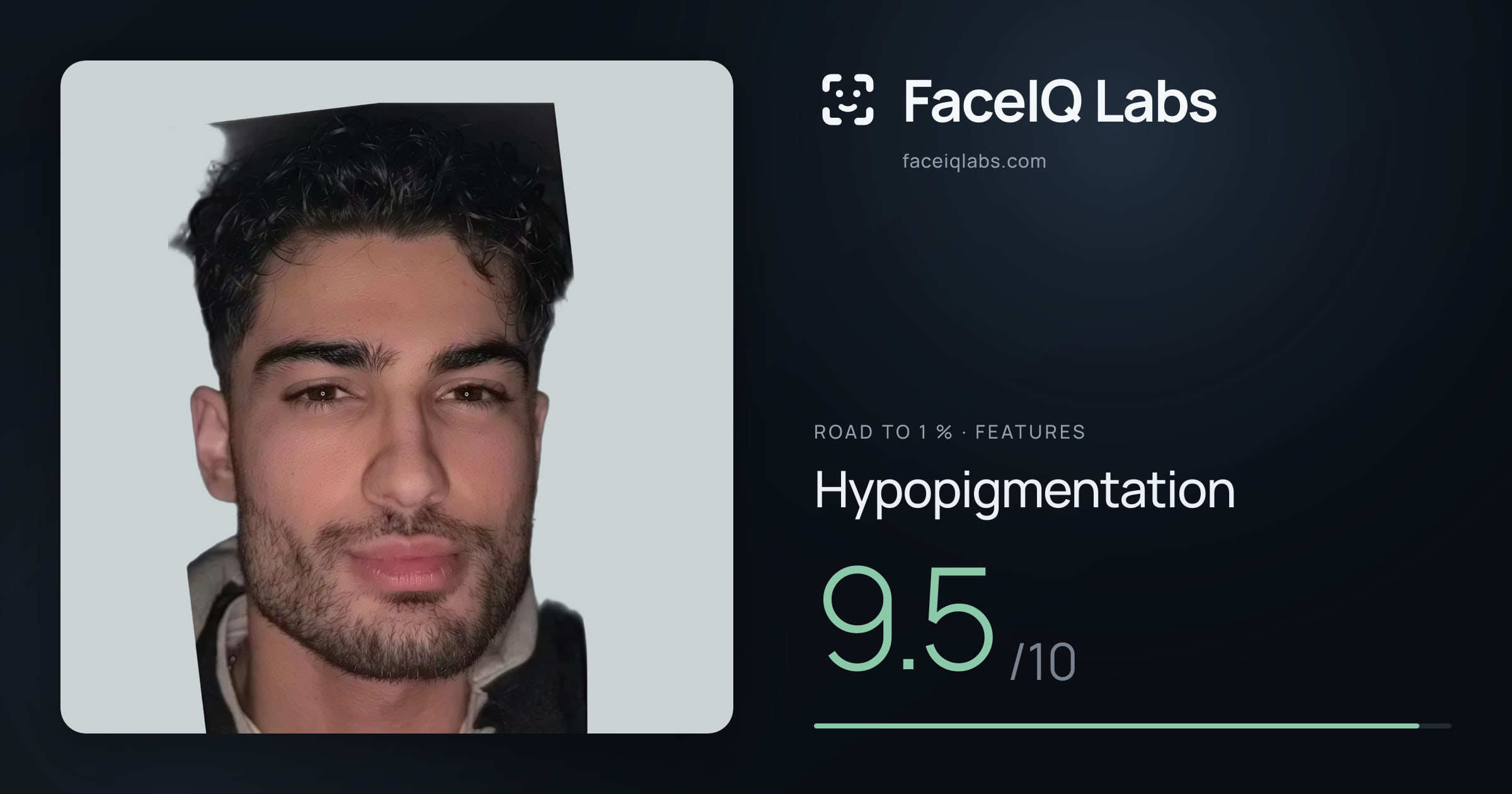 Road To 1 % Hypopigmentation: 9.5/10, drawn on the photo