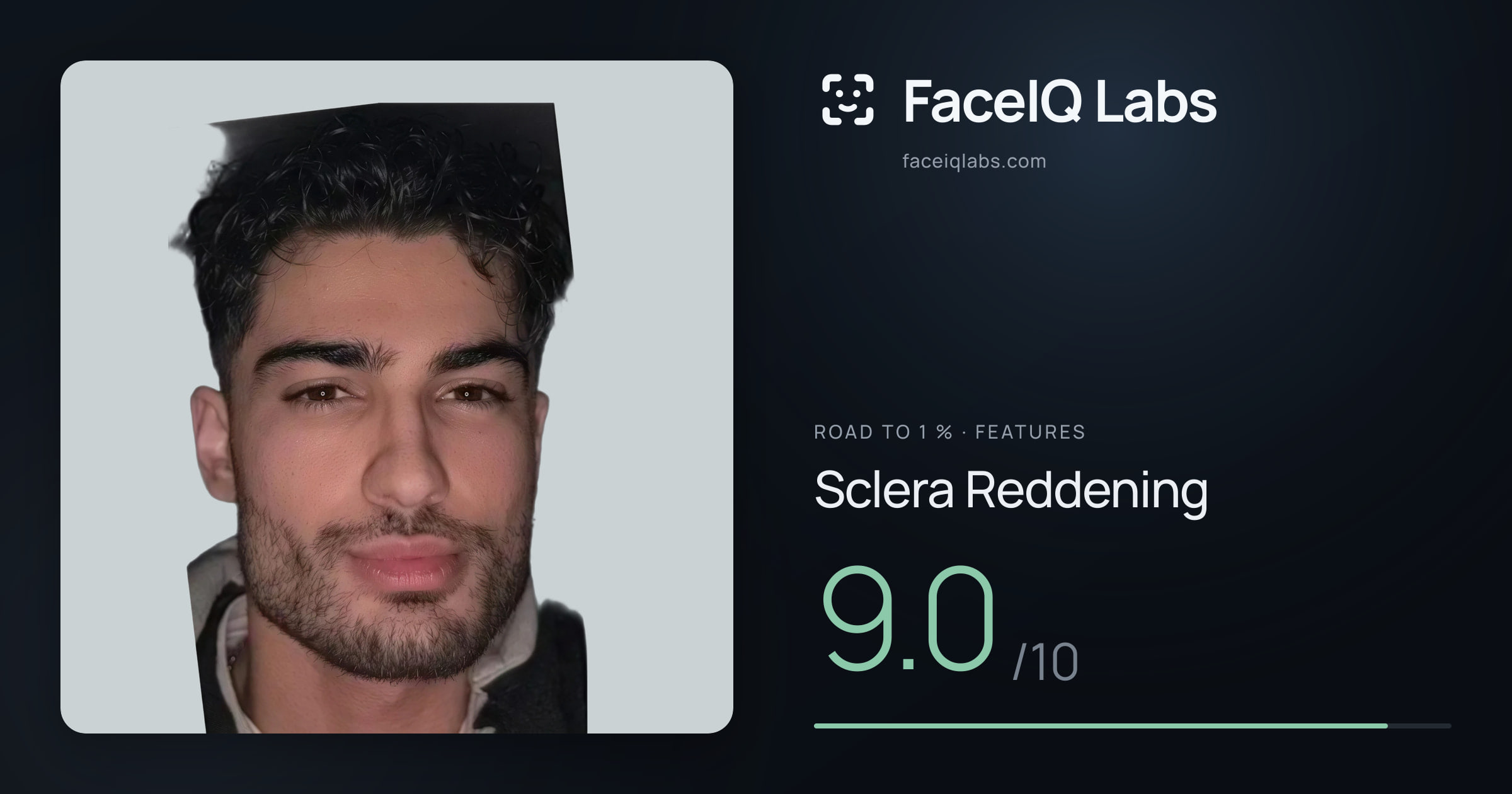 Road To 1 % Sclera Reddening: 9.0/10, drawn on the photo