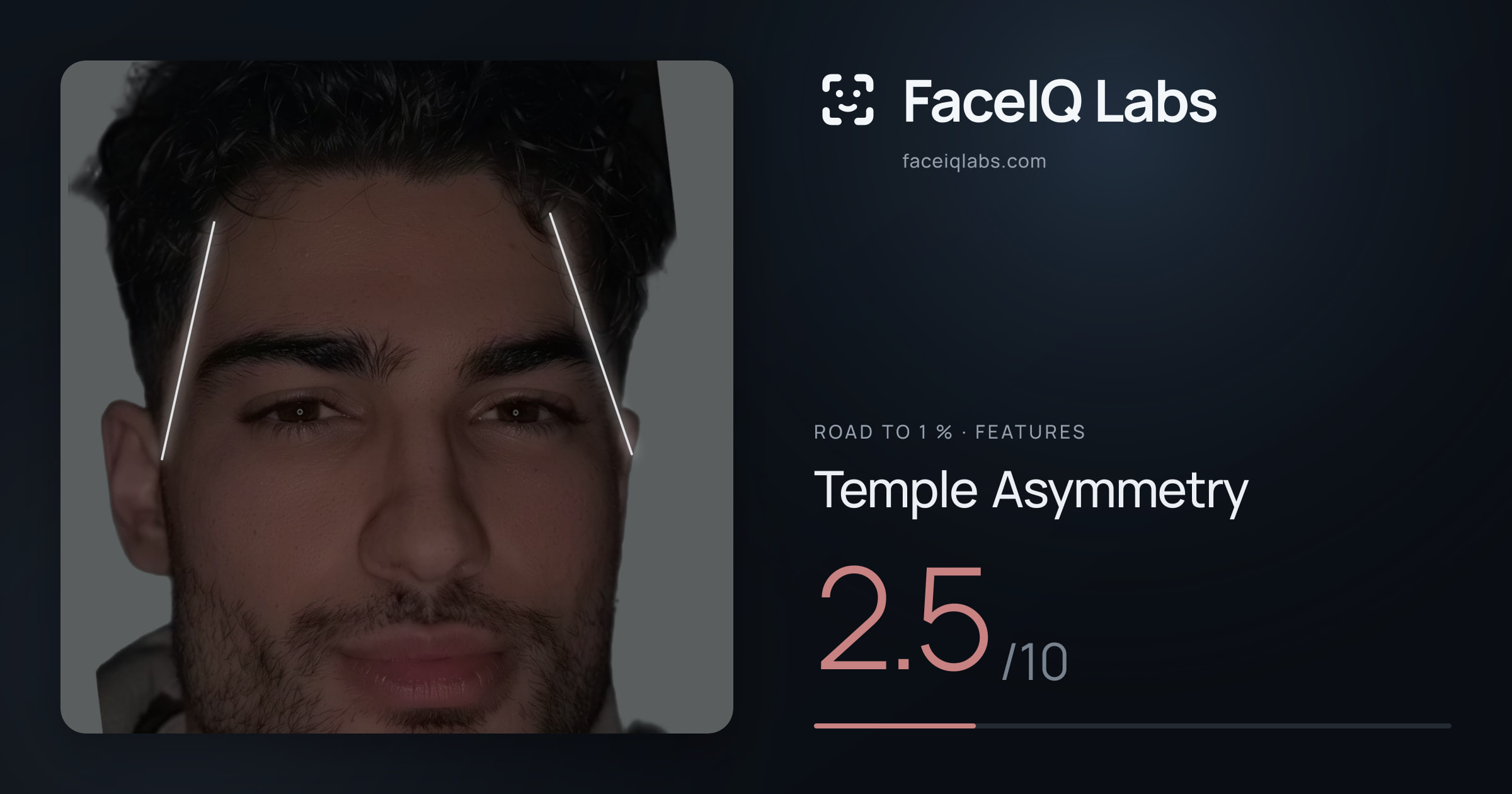 Road To 1 % Temple Asymmetry: 2.5/10, drawn on the photo