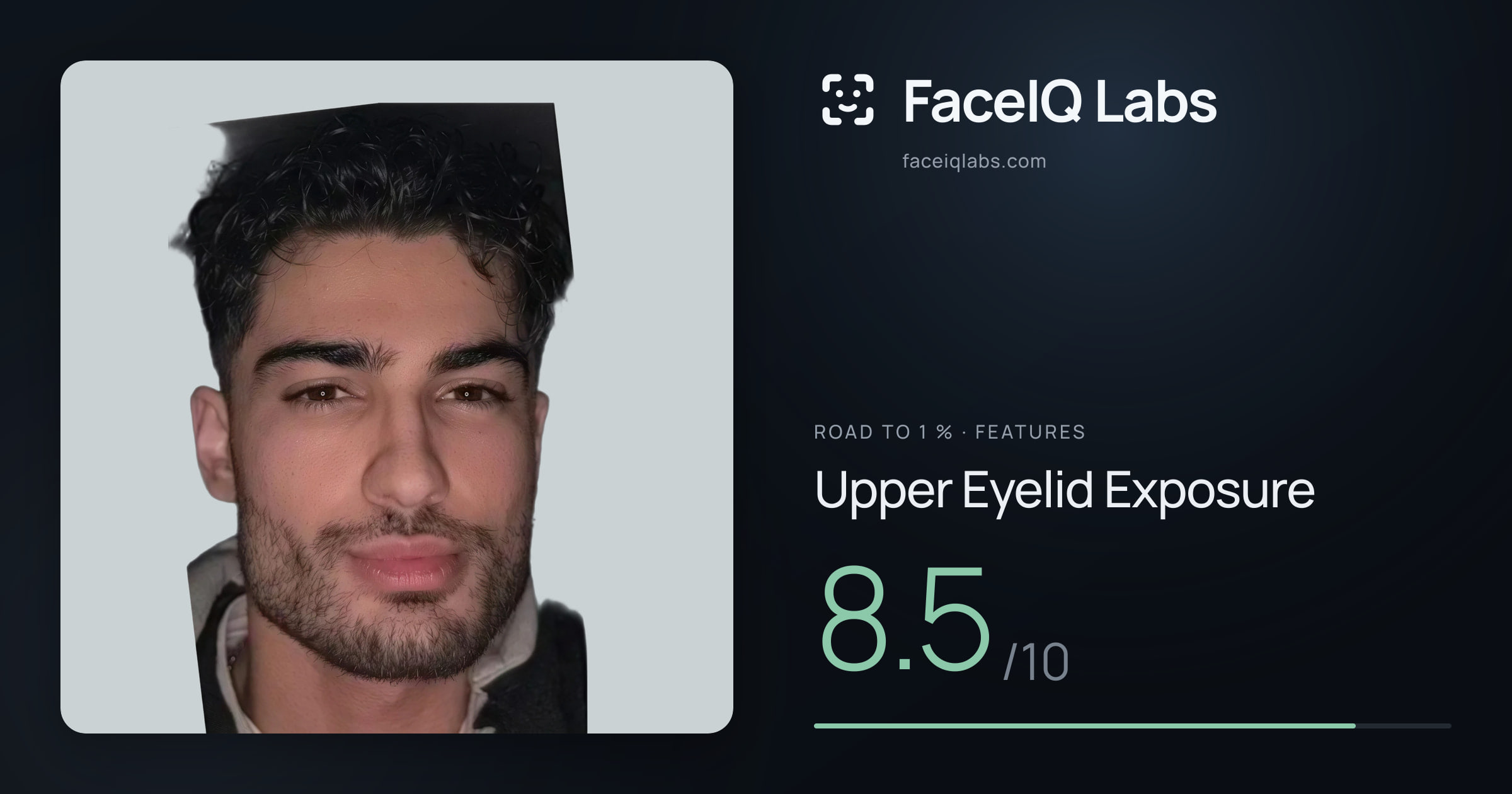 Road To 1 % Upper Eyelid Exposure: 8.5/10, drawn on the photo