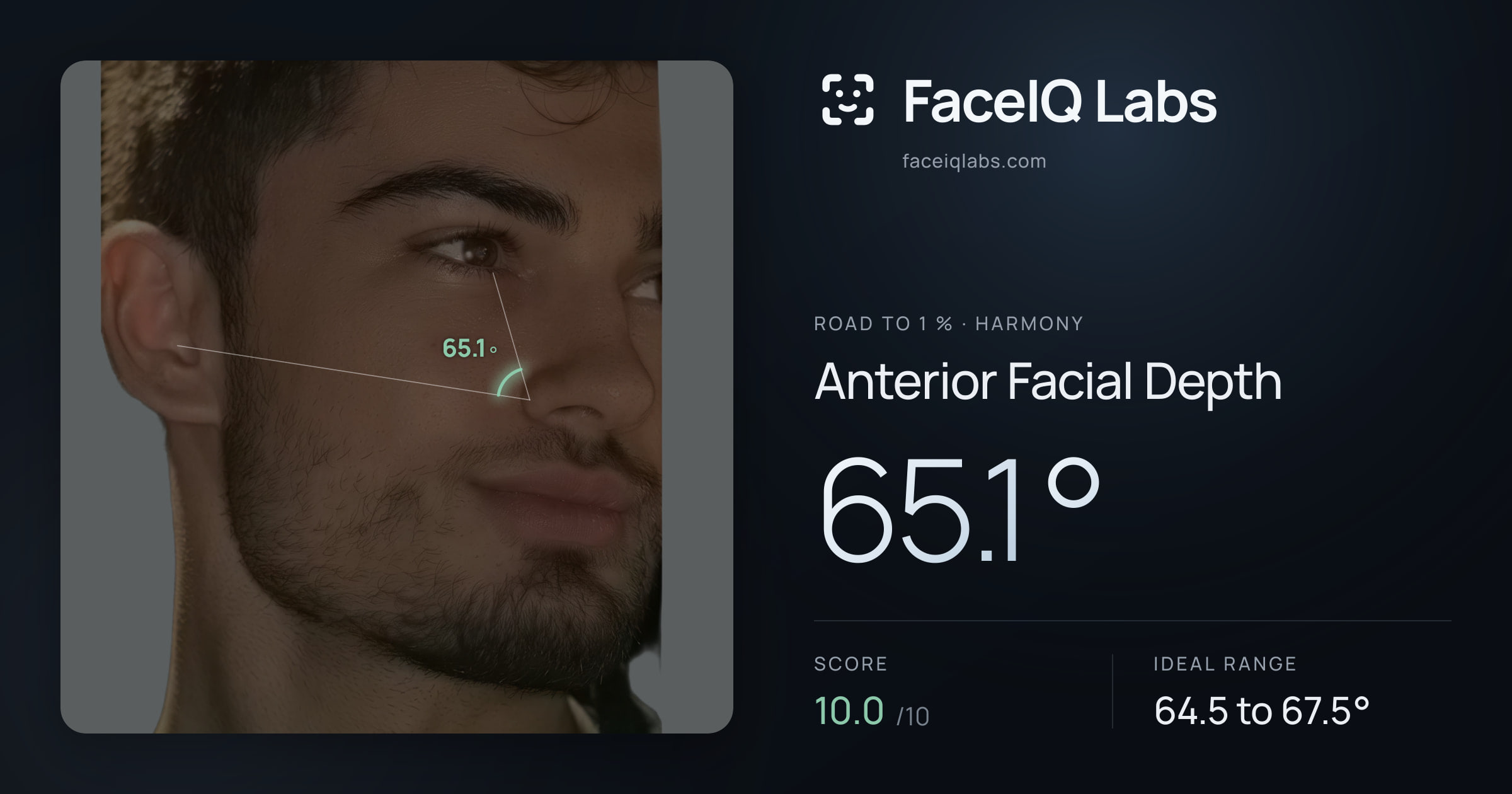 Road To 1 % Anterior Facial Depth: 65.1°, drawn on the photo