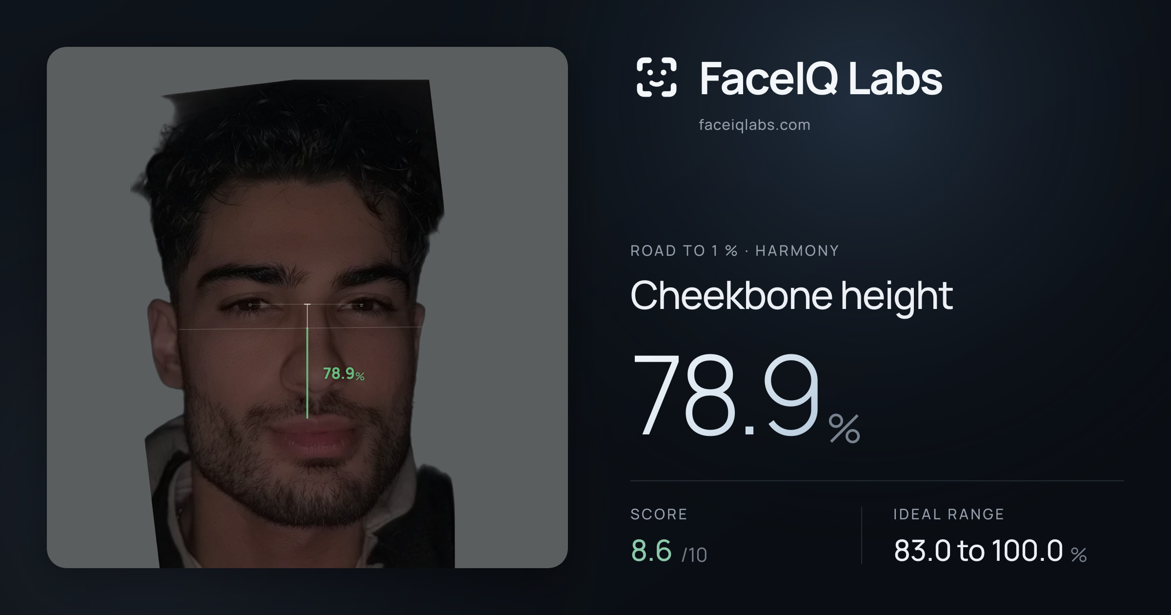 Road To 1 % Cheekbone height: 78.9%, drawn on the photo