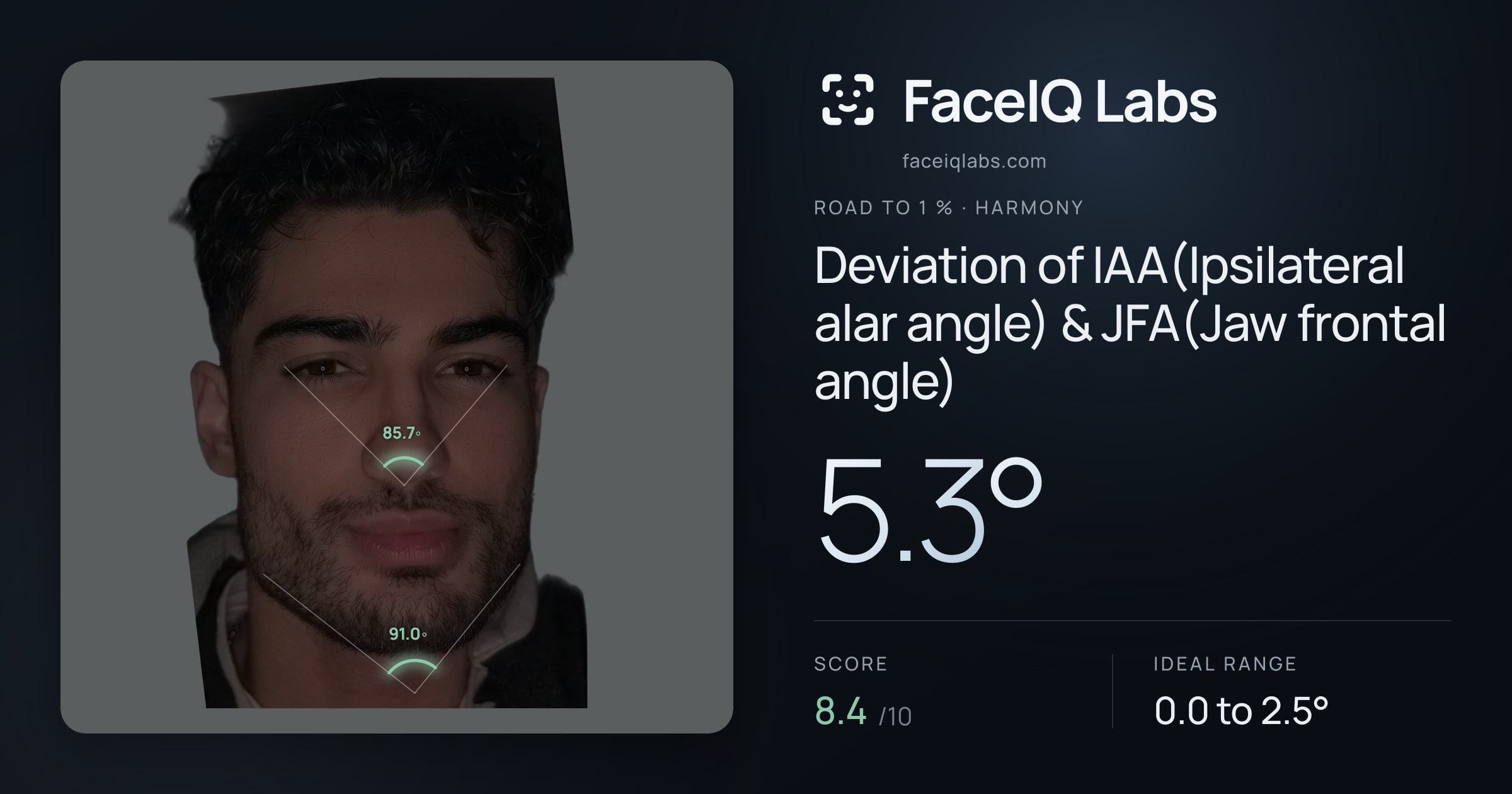Road To 1 % Deviation of IAA(Ipsilateral alar angle) & JFA(Jaw frontal angle): 5.3°, drawn on the photo