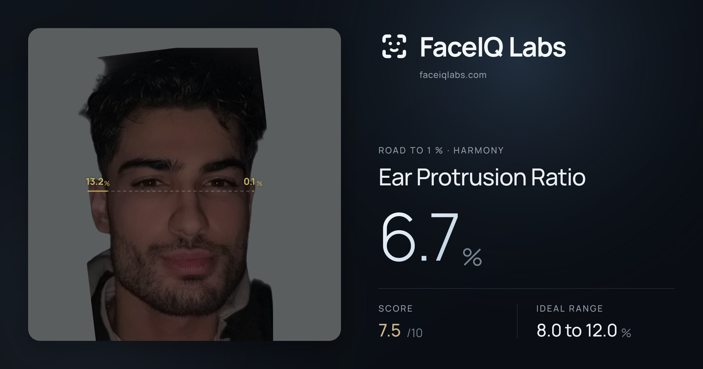 Road To 1 % Ear Protrusion Ratio: 6.7%, drawn on the photo