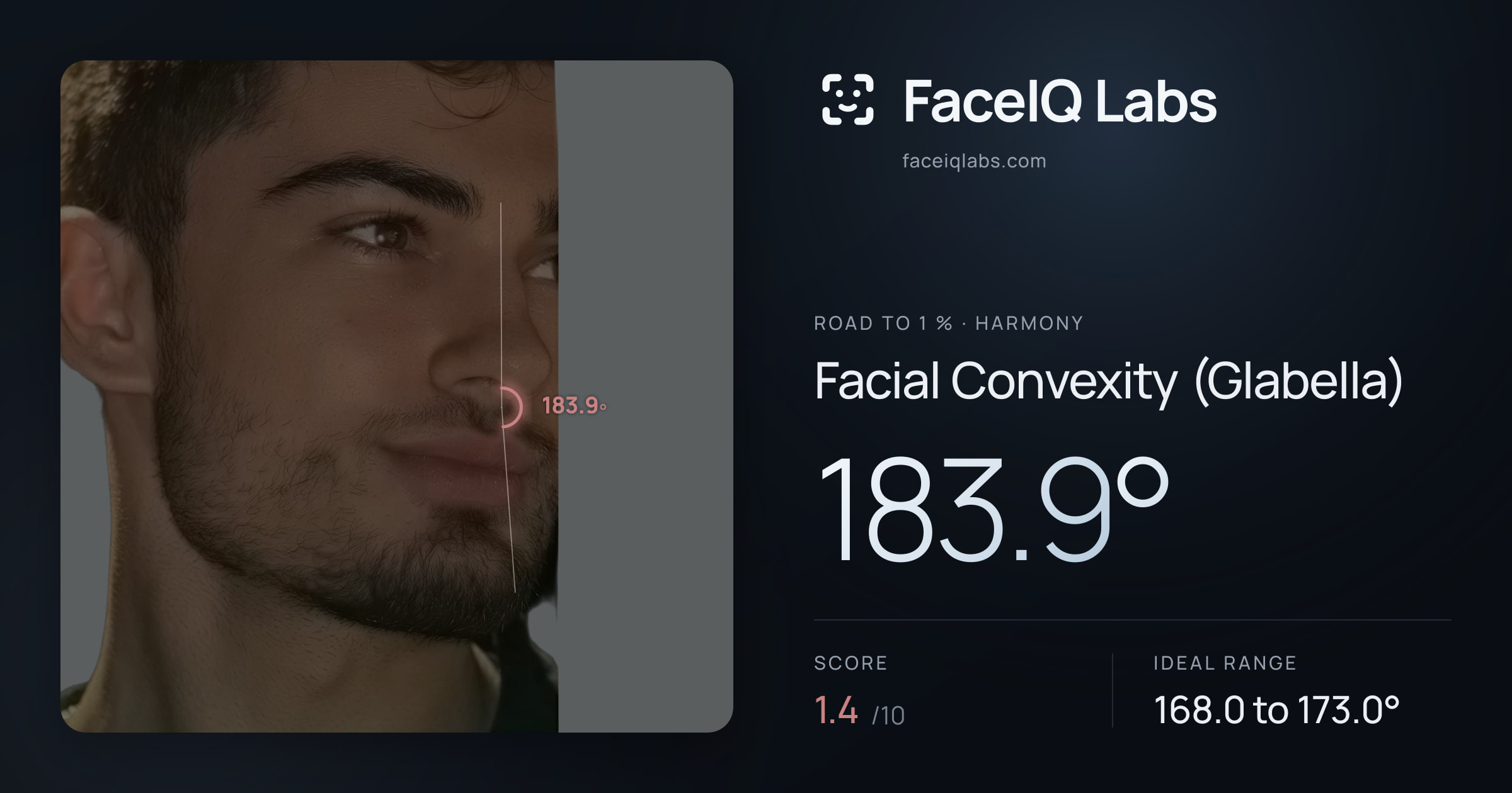 Road To 1 % Facial Convexity (Glabella): 183.9°, drawn on the photo