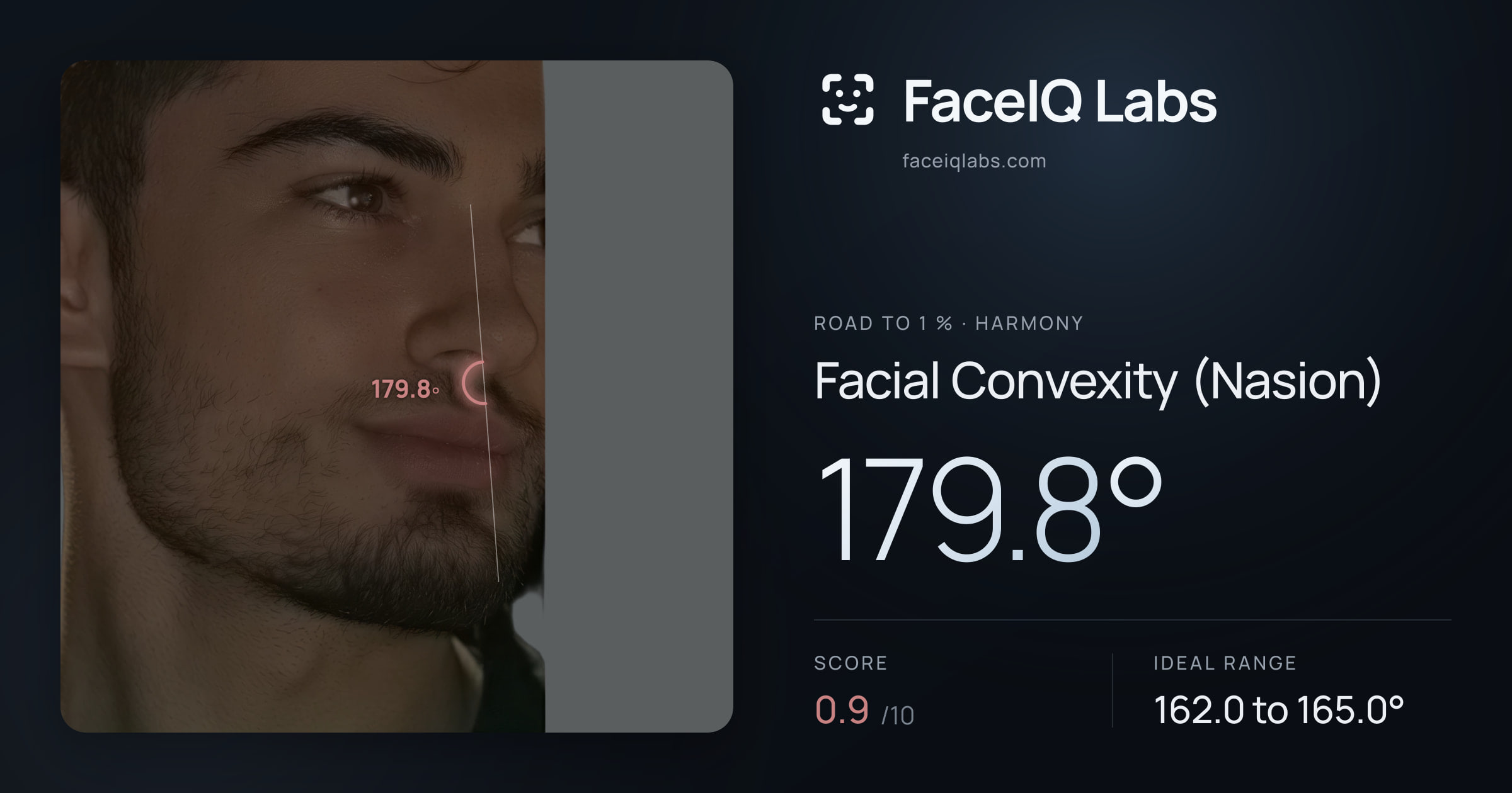Road To 1 % Facial Convexity (Nasion): 179.8°, drawn on the photo
