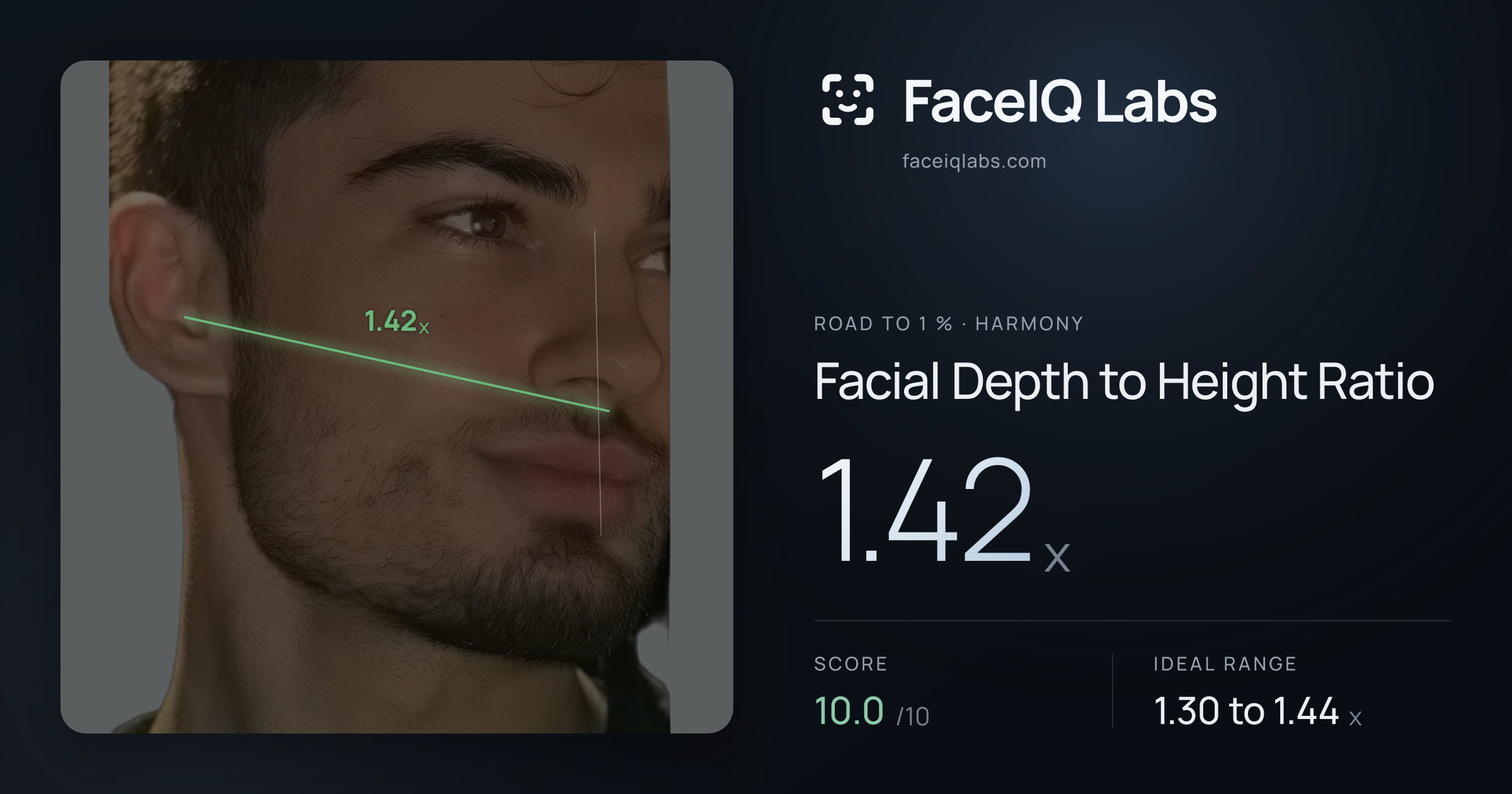 Road To 1 % Facial Depth to Height Ratio: 1.42x, drawn on the photo