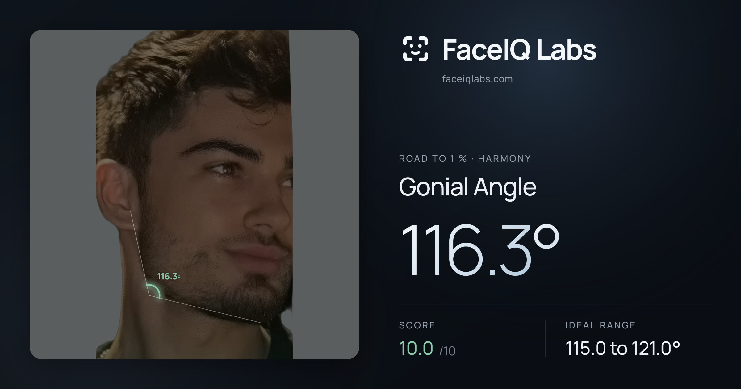 Road To 1 % Gonial Angle: 116.3°, drawn on the photo