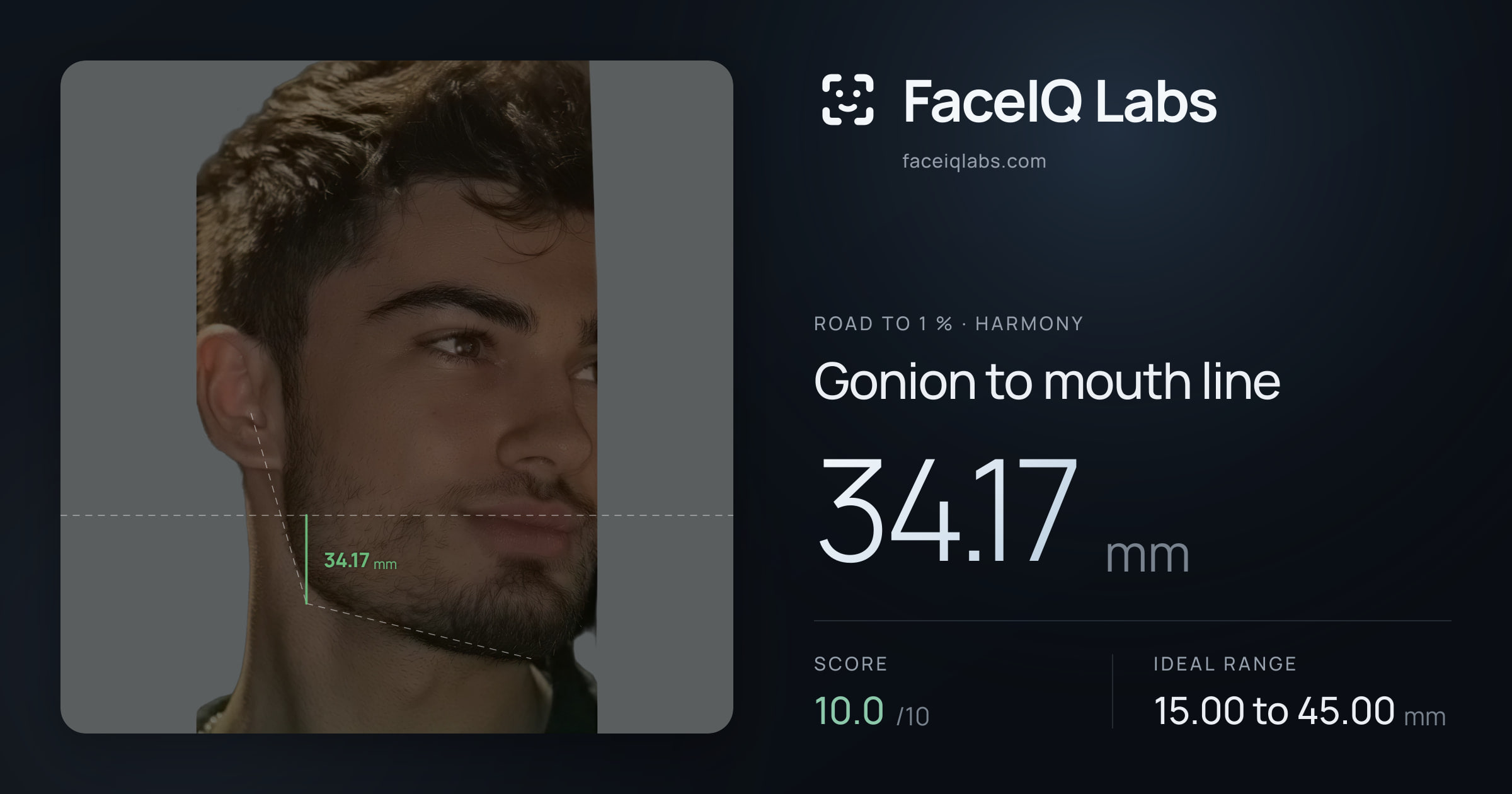 Road To 1 % Gonion to mouth line: 34.17mm, drawn on the photo