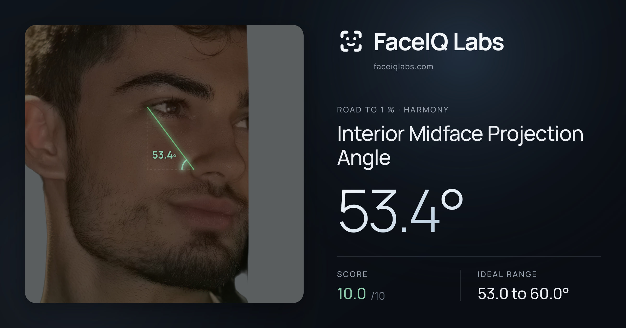 Road To 1 % Interior Midface Projection Angle: 53.4°, drawn on the photo