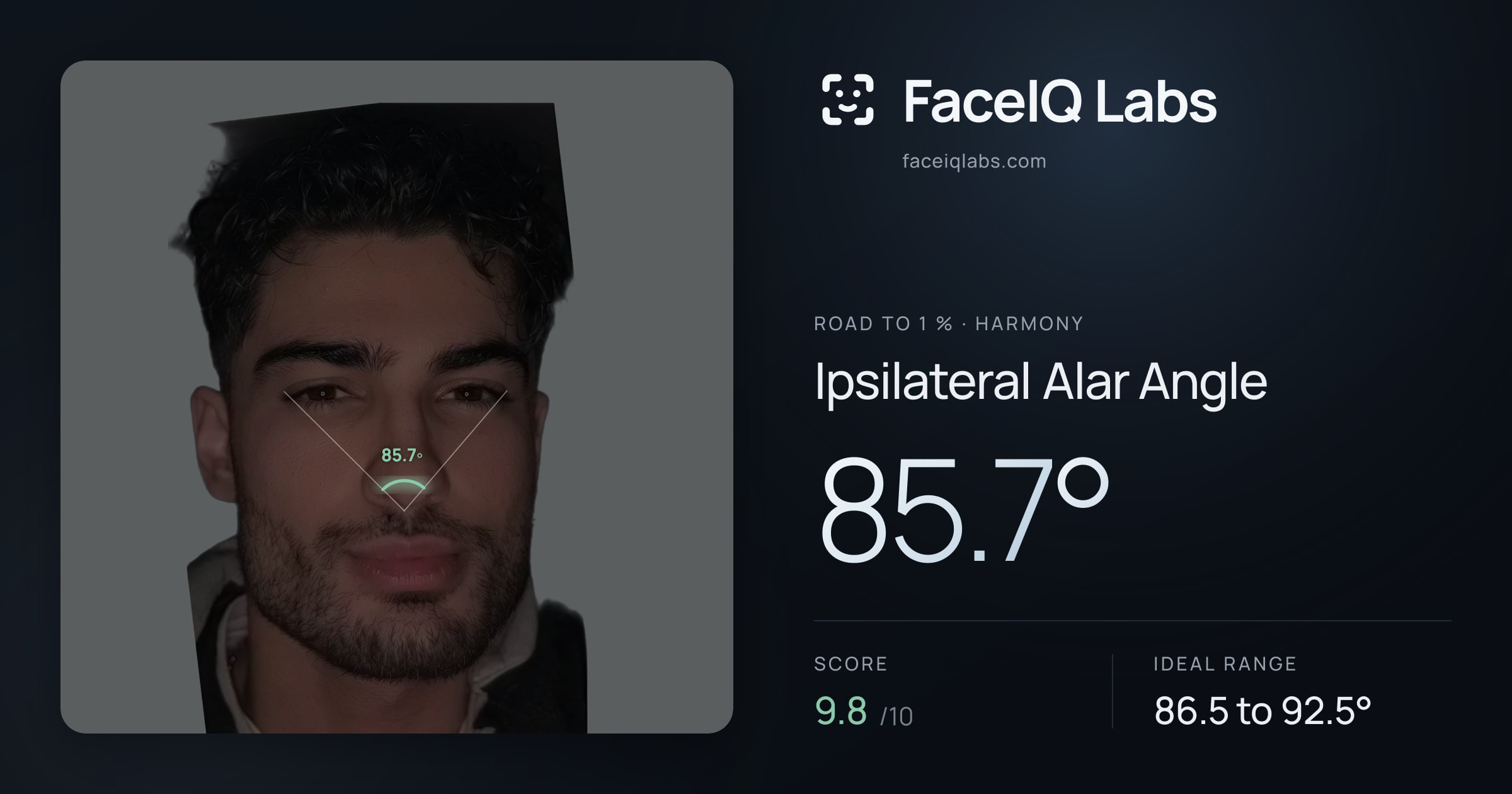 Road To 1 % Ipsilateral Alar Angle: 85.7°, drawn on the photo