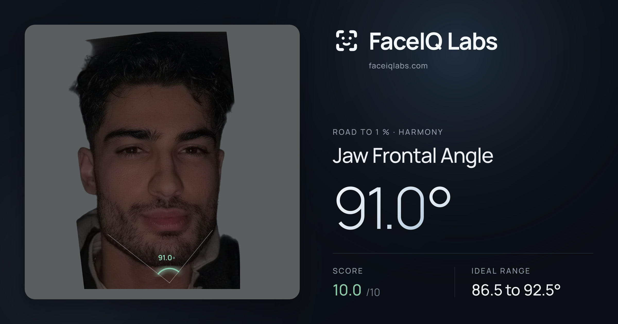 Road To 1 % Jaw Frontal Angle: 91.0°, drawn on the photo