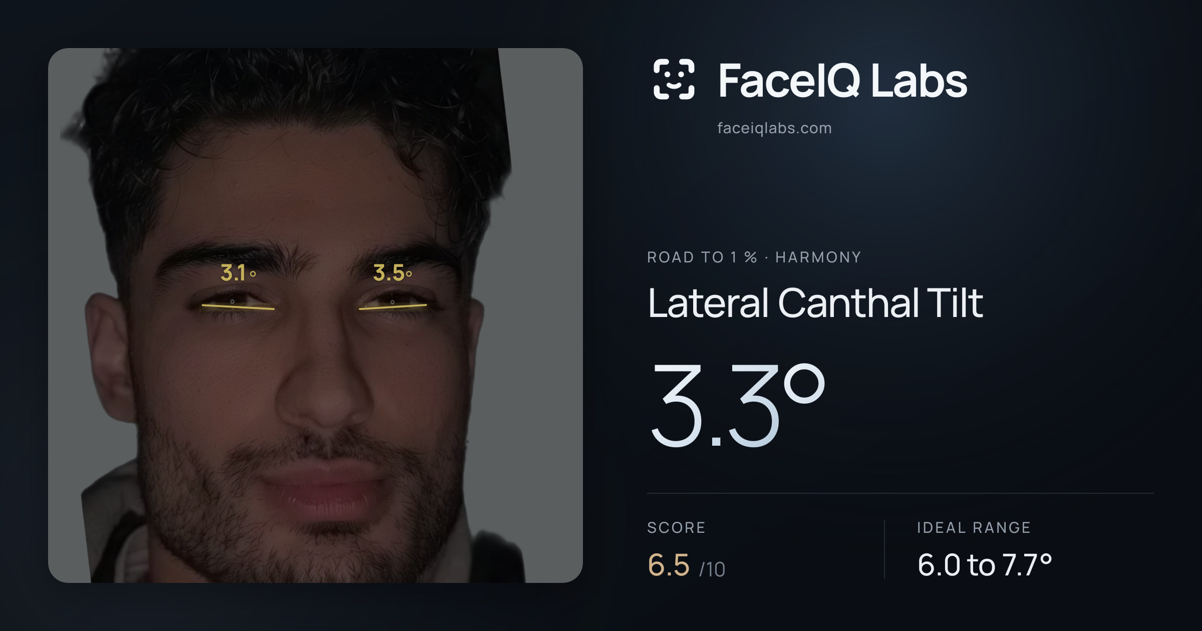 Road To 1 % Lateral Canthal Tilt: 3.3°, drawn on the photo