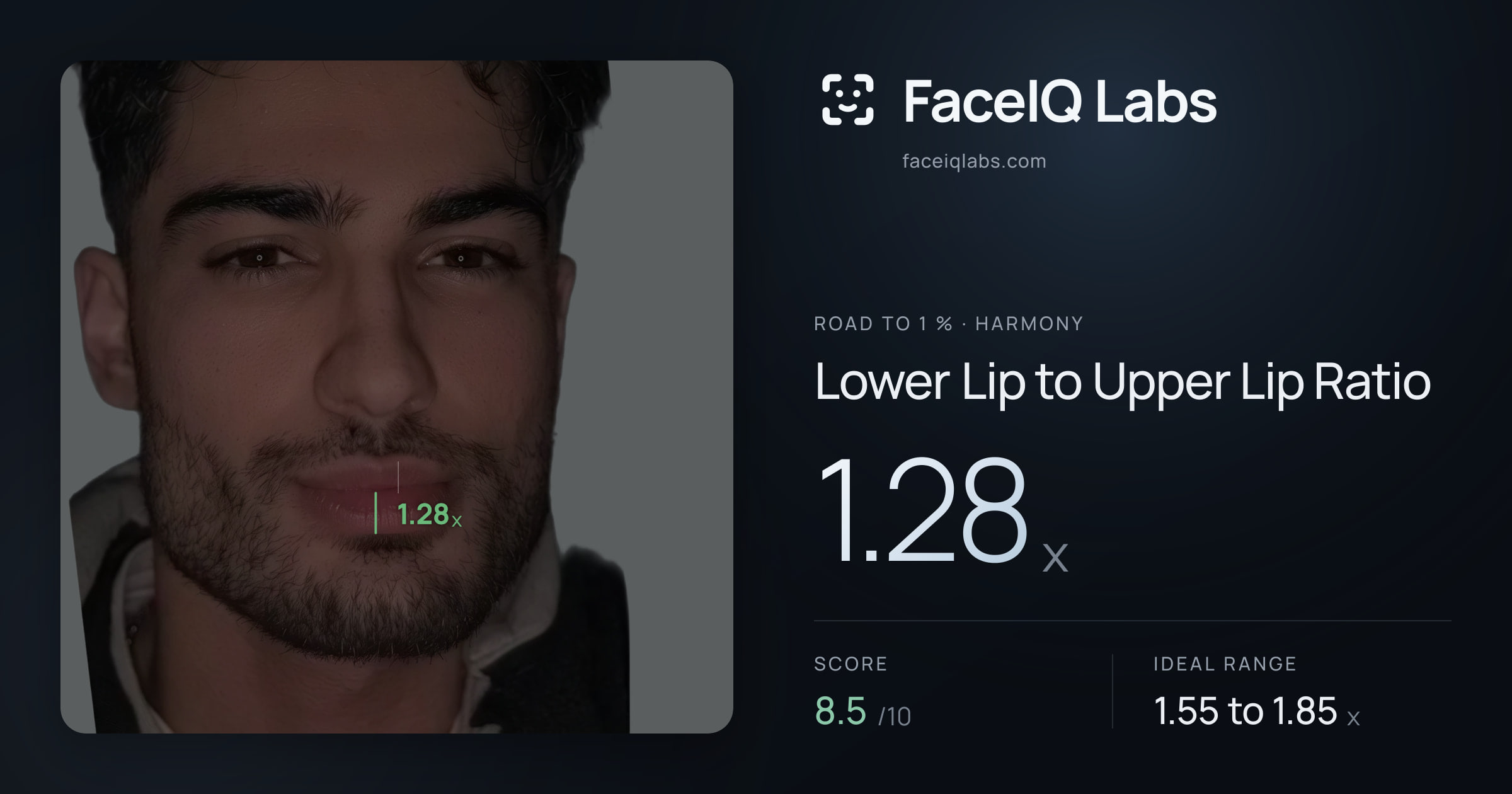 Road To 1 % Lower Lip to Upper Lip Ratio: 1.28x, drawn on the photo