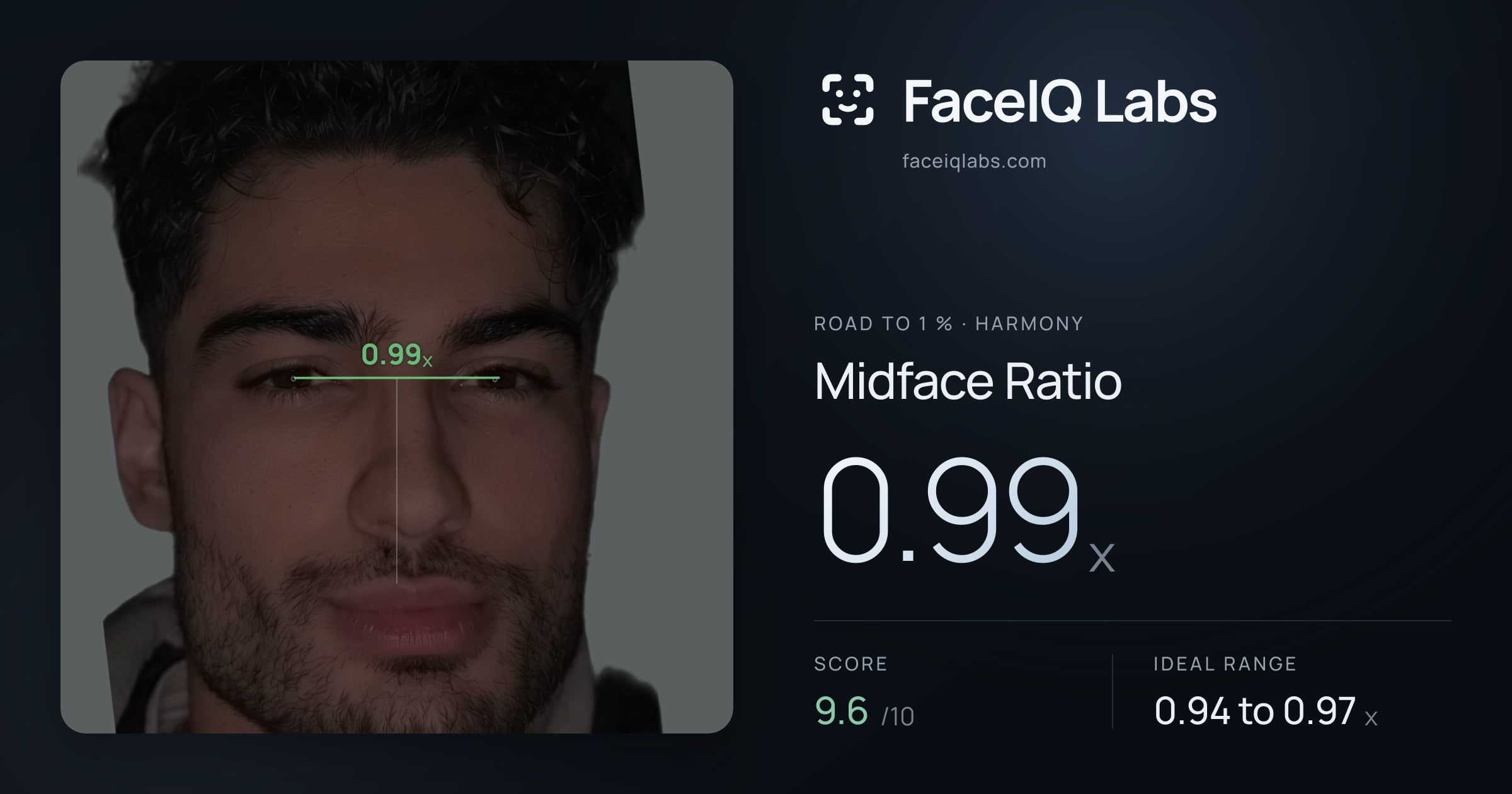 Road To 1 % Midface Ratio: 0.99x, drawn on the photo