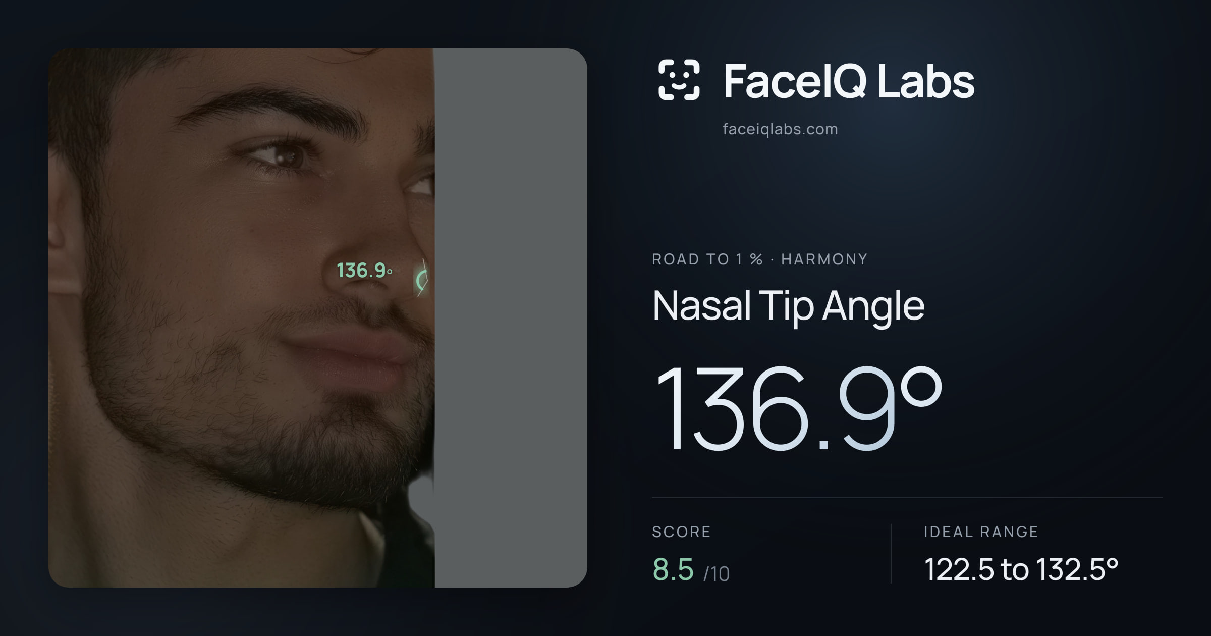 Road To 1 % Nasal Tip Angle: 136.9°, drawn on the photo