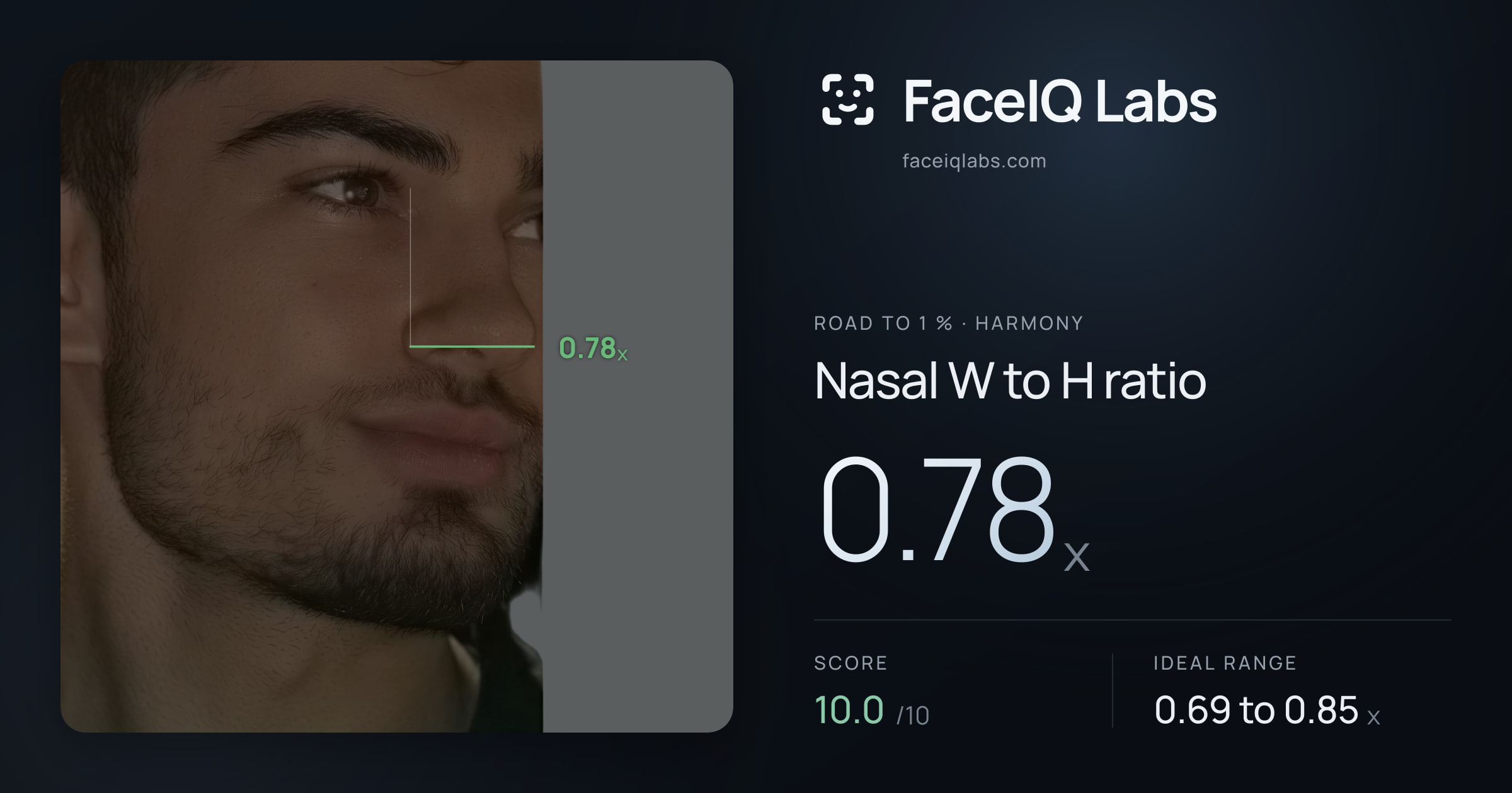 Road To 1 % Nasal W to H ratio: 0.78x, drawn on the photo