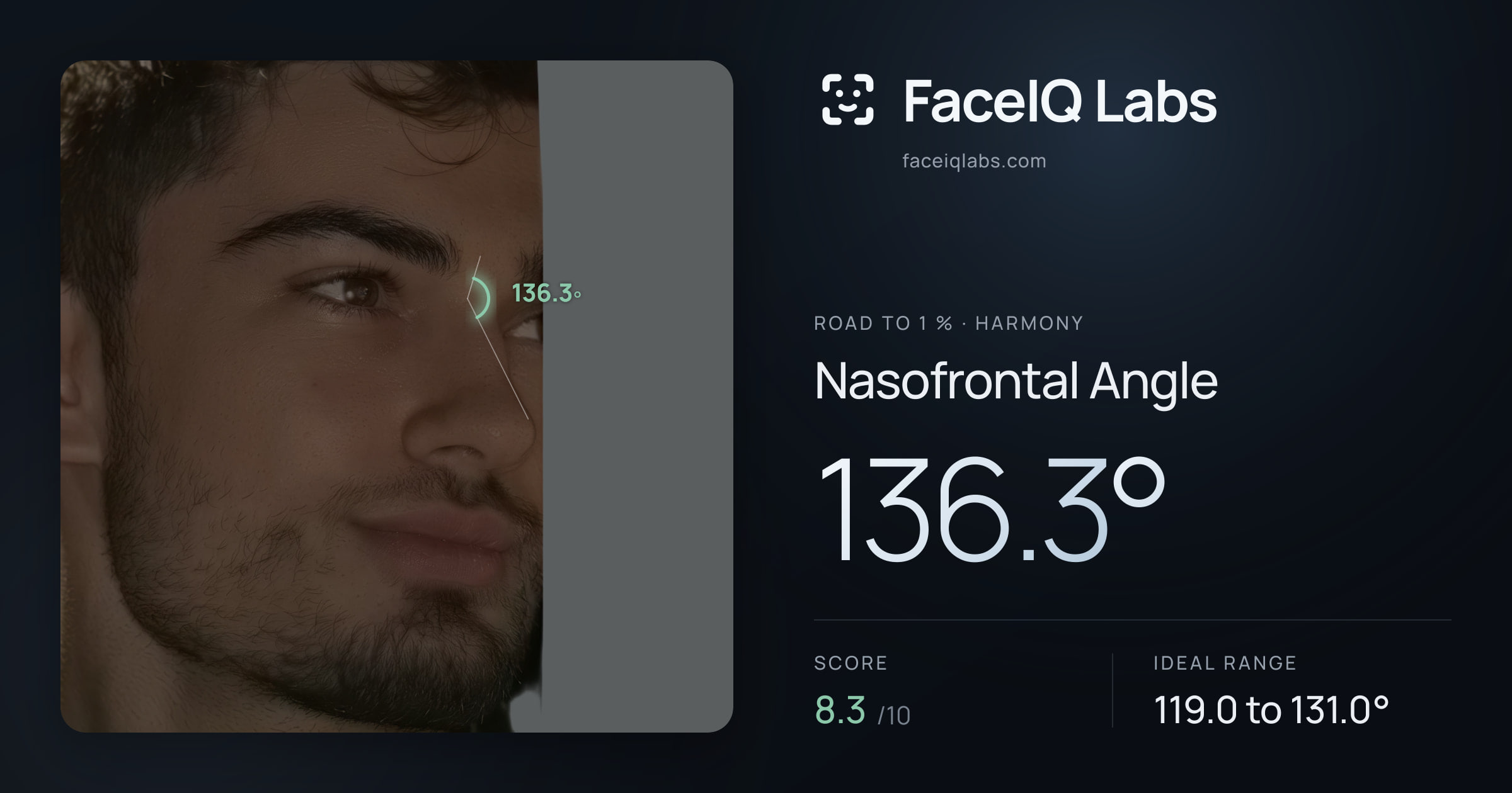 Road To 1 % Nasofrontal Angle: 136.3°, drawn on the photo