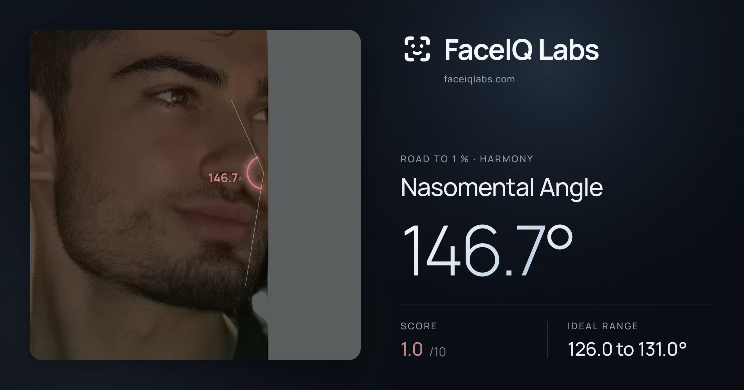Road To 1 % Nasomental Angle: 146.7°, drawn on the photo