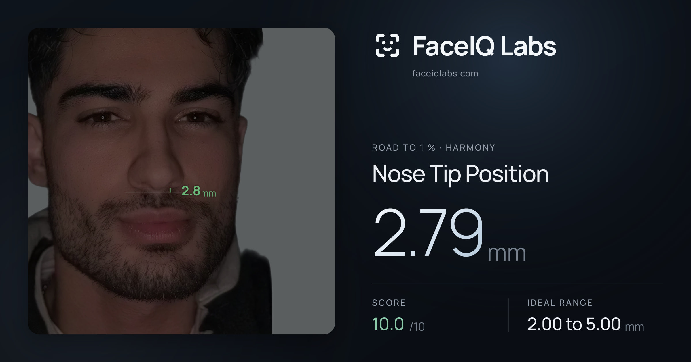Road To 1 % Nose Tip Position: 2.79mm, drawn on the photo