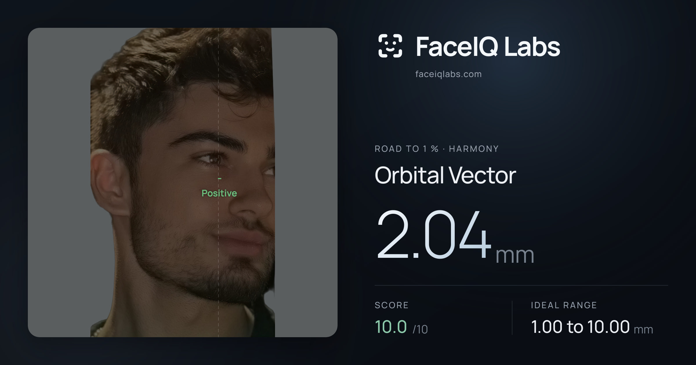 Road To 1 % Orbital Vector: 2.04mm, drawn on the photo