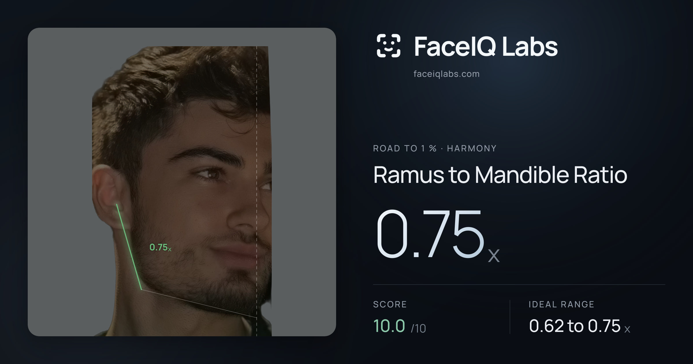 Road To 1 % Ramus to Mandible Ratio: 0.75x, drawn on the photo