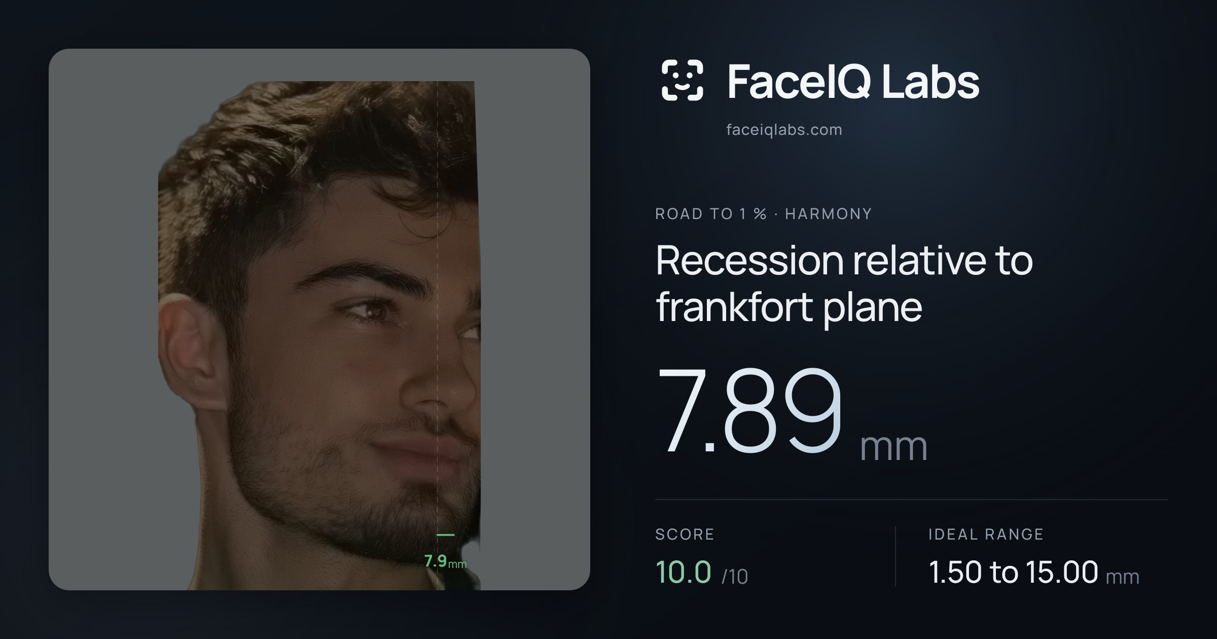 Road To 1 % Recession relative to frankfort plane: 7.89mm, drawn on the photo