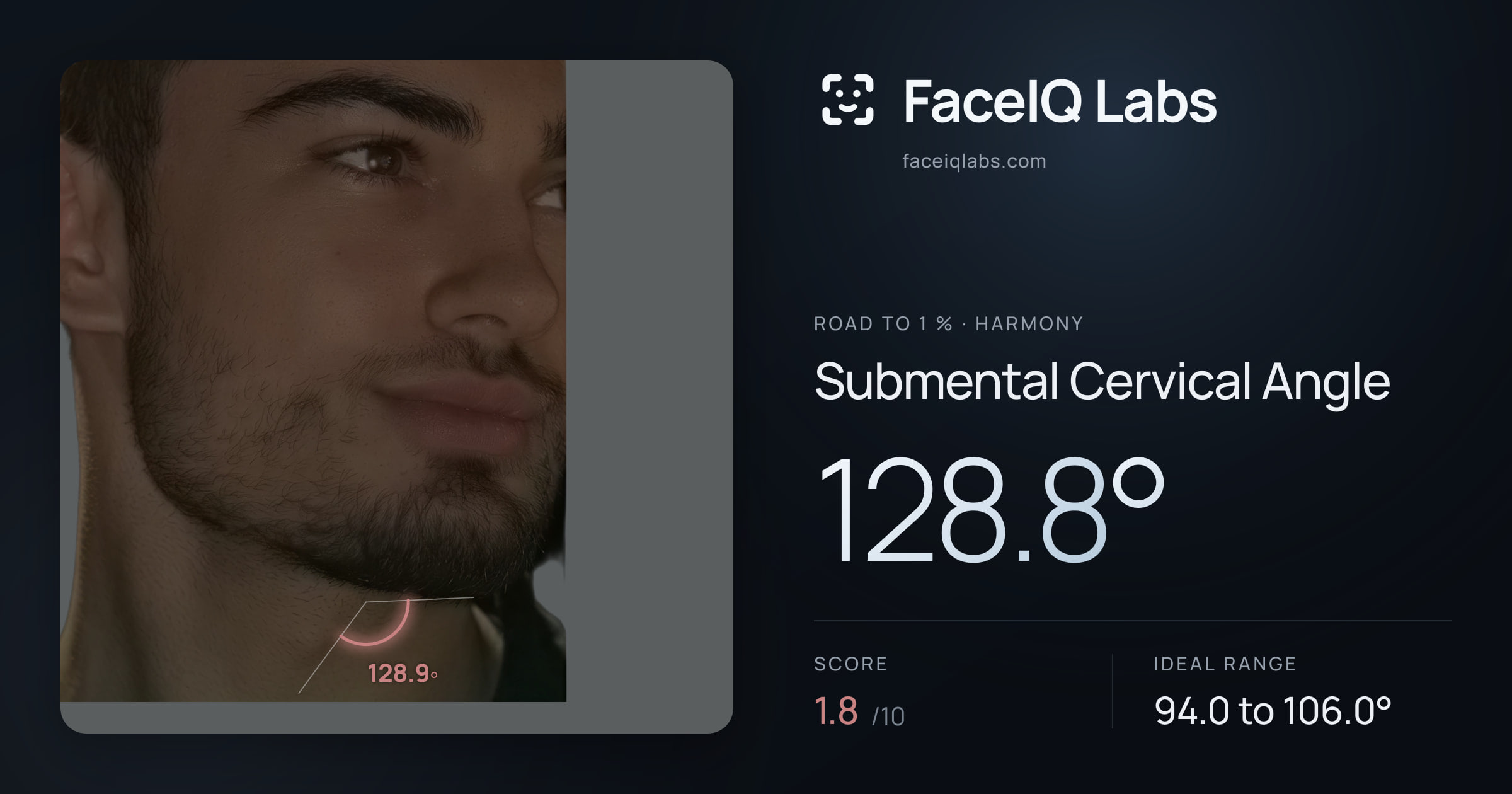 Road To 1 % Submental Cervical Angle: 128.8°, drawn on the photo