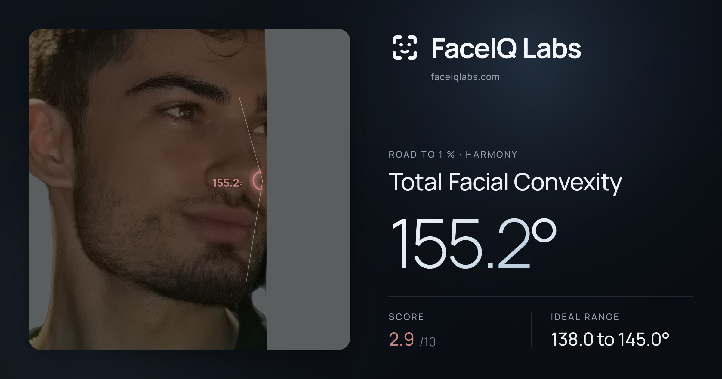 Road To 1 % Total Facial Convexity: 155.2°, drawn on the photo