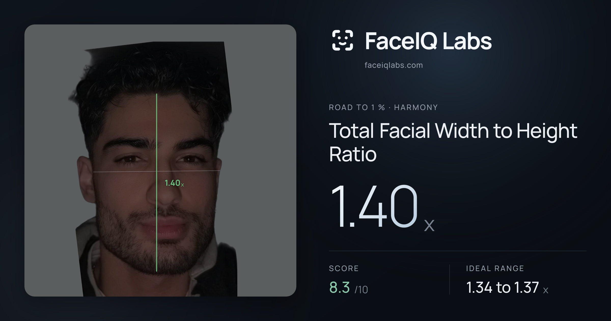 Road To 1 % Total Facial Width to Height Ratio: 1.40x, drawn on the photo
