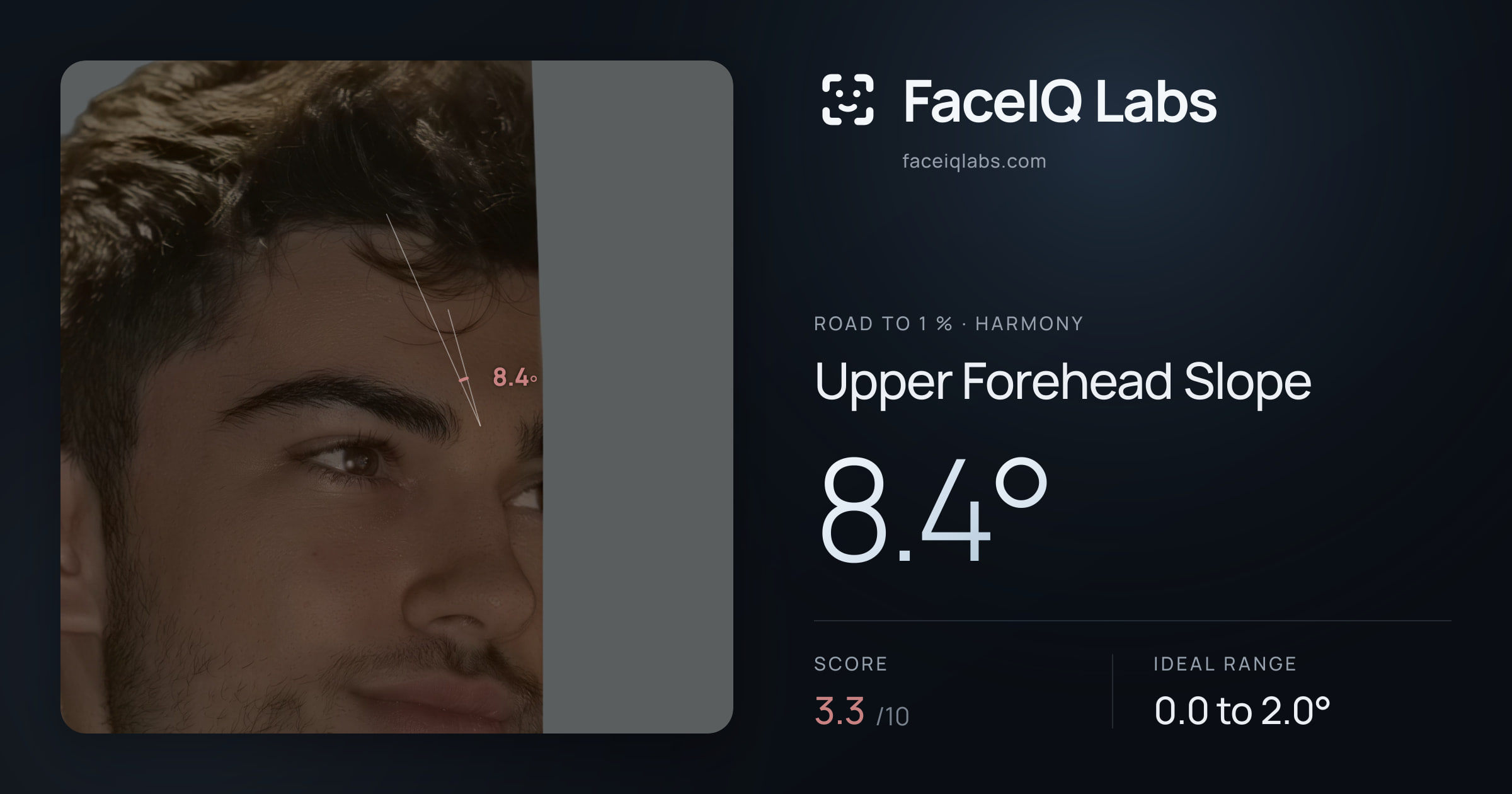 Road To 1 % Upper Forehead Slope: 8.4°, drawn on the photo
