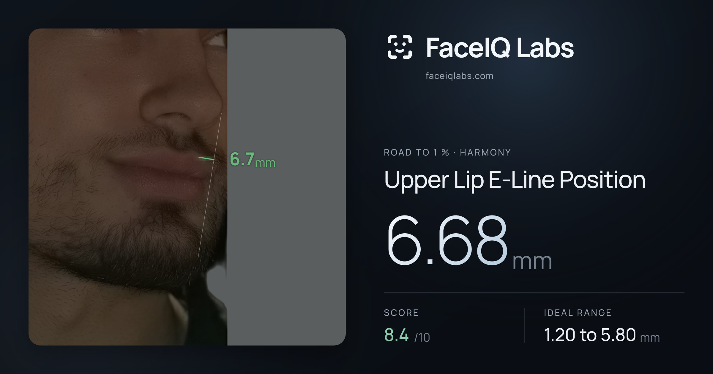 Road To 1 % Upper Lip E-Line Position: 6.68mm, drawn on the photo