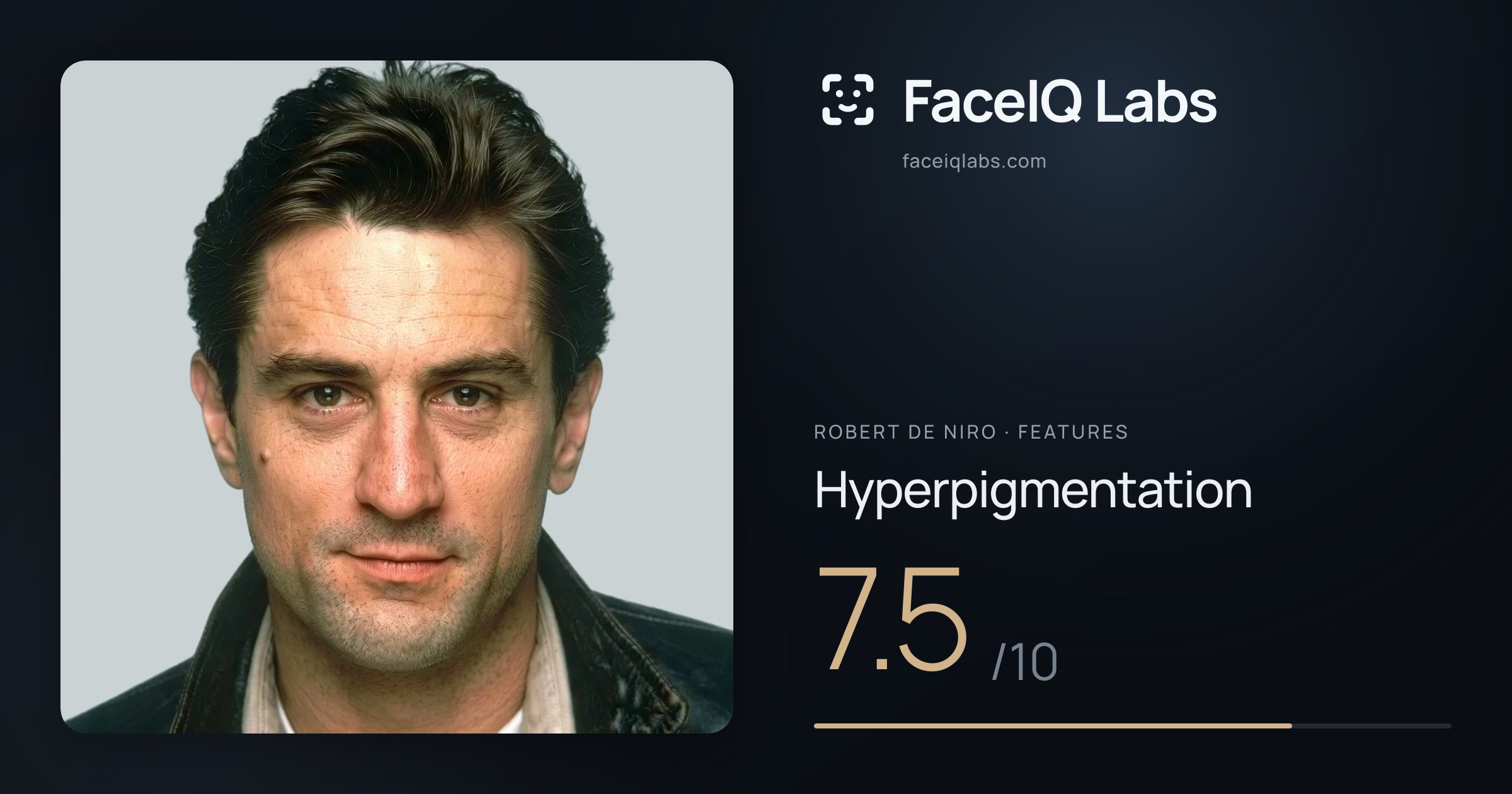 Robert De Niro Hyperpigmentation: 7.5/10, drawn on the photo