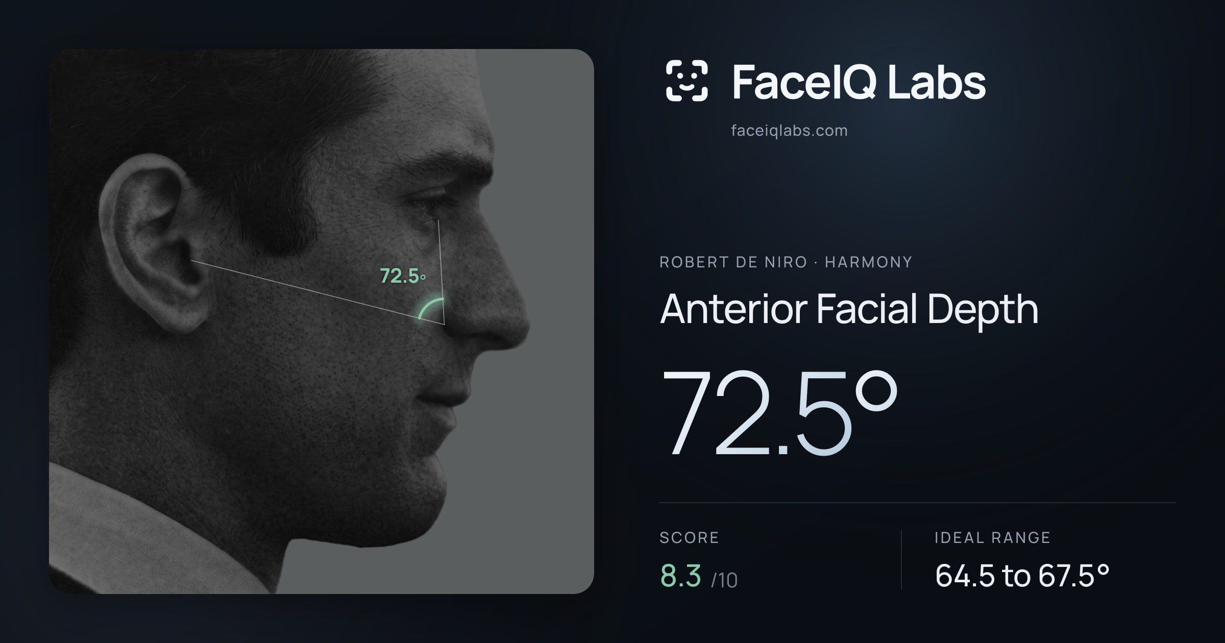 Robert De Niro Anterior Facial Depth: 72.5°, drawn on the photo