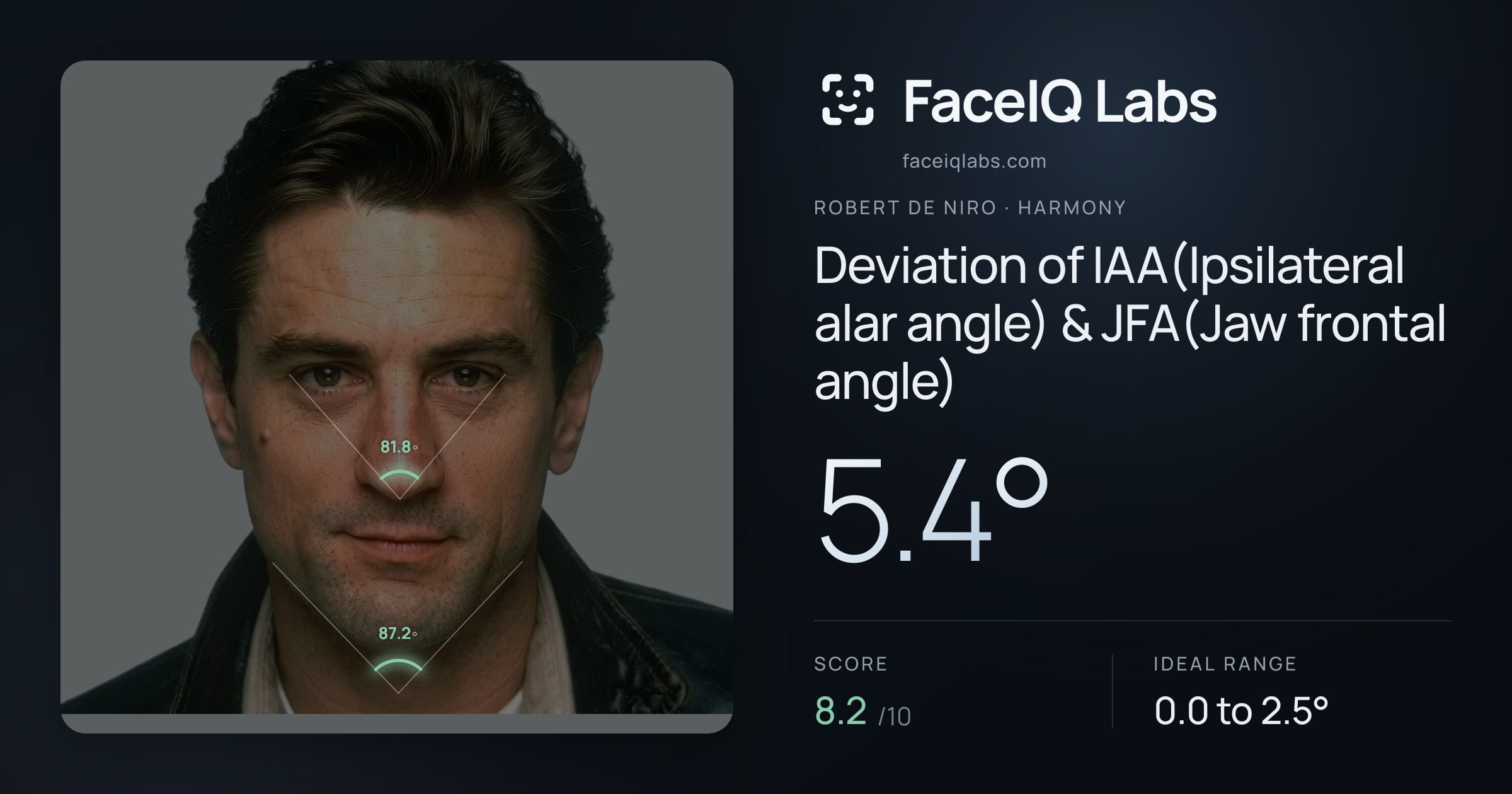 Robert De Niro Deviation of IAA(Ipsilateral alar angle) & JFA(Jaw frontal angle): 5.4°, drawn on the photo