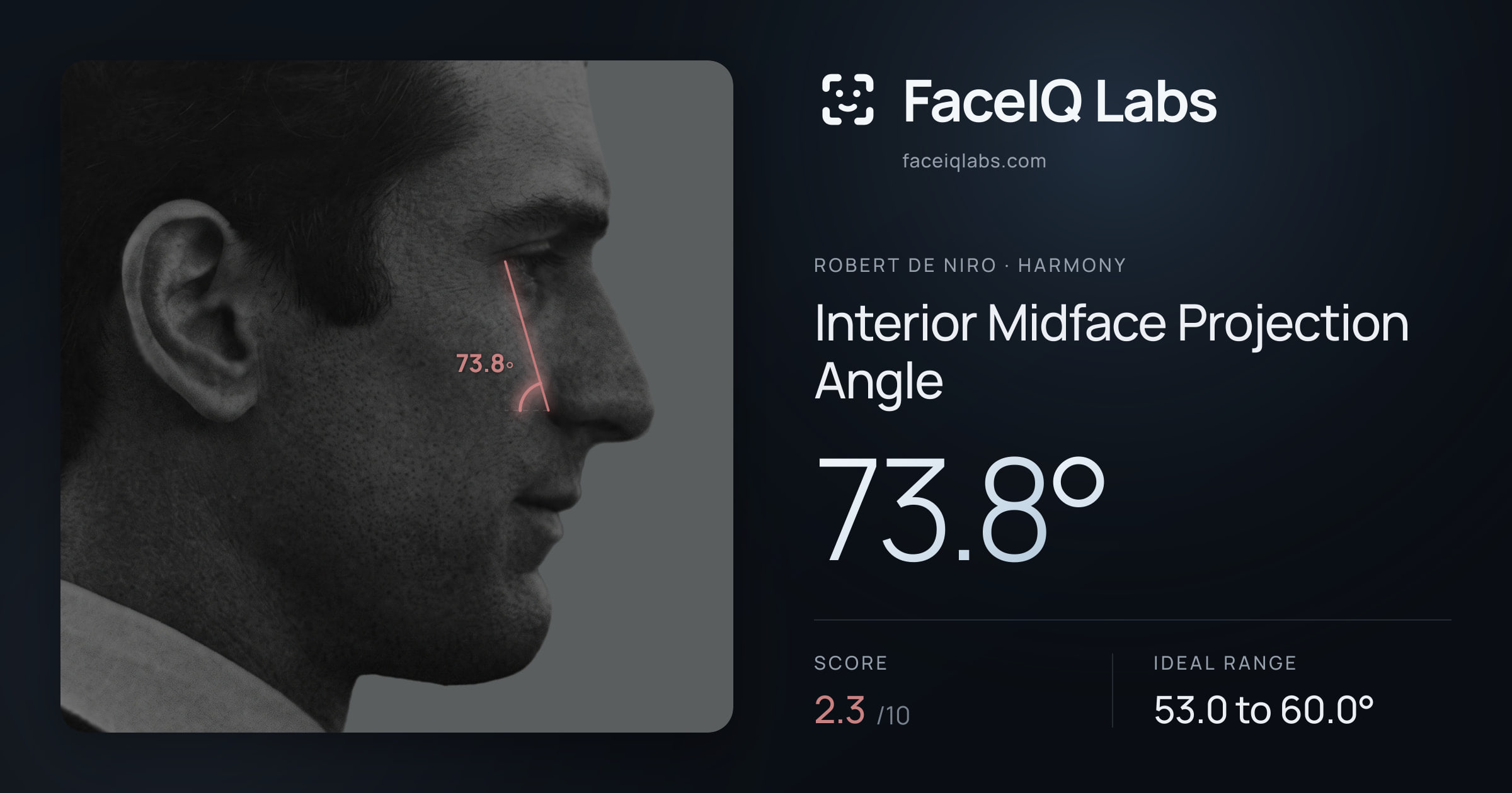 Robert De Niro Interior Midface Projection Angle: 73.8°, drawn on the photo