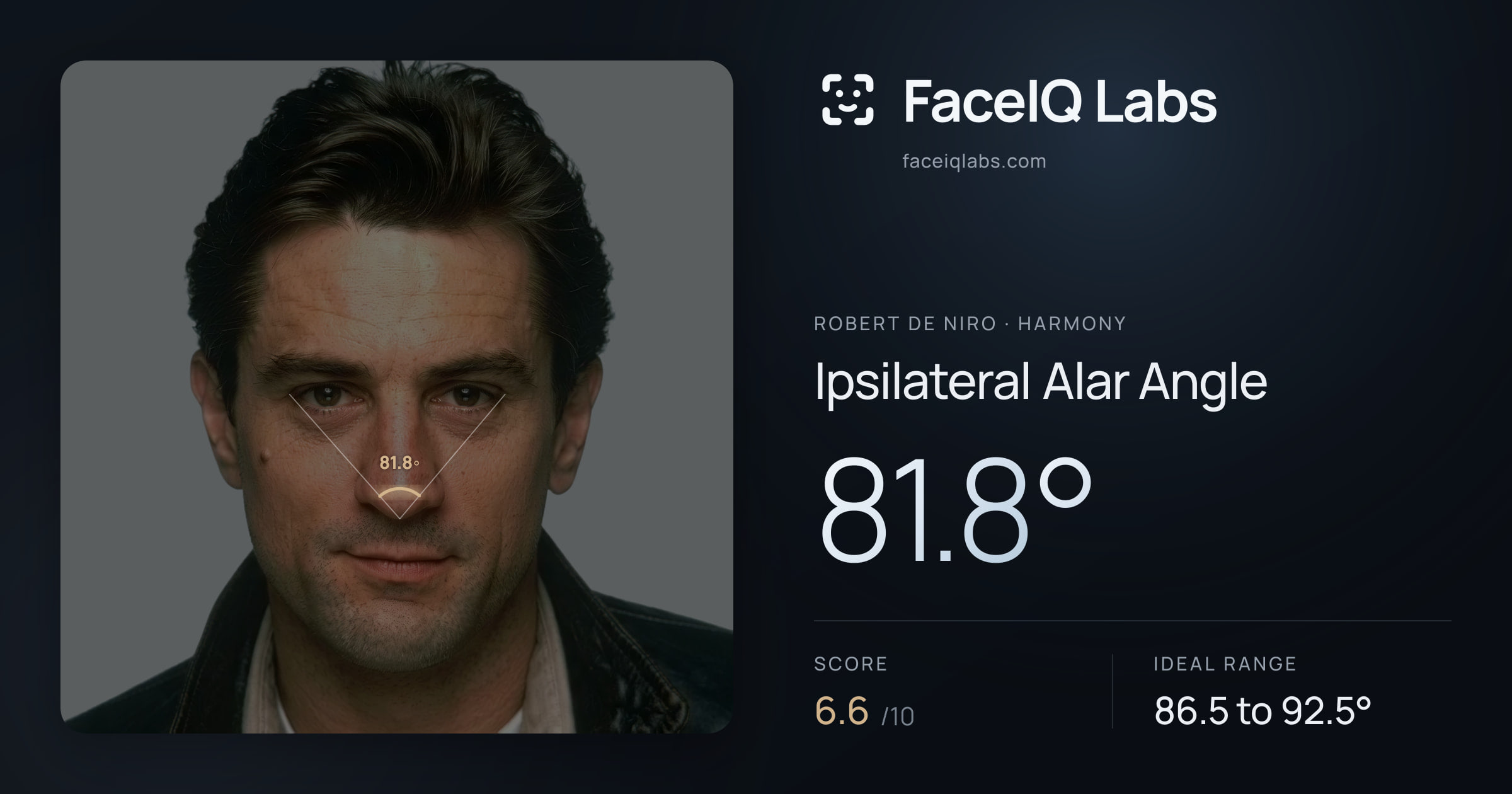Robert De Niro Ipsilateral Alar Angle: 81.8°, drawn on the photo