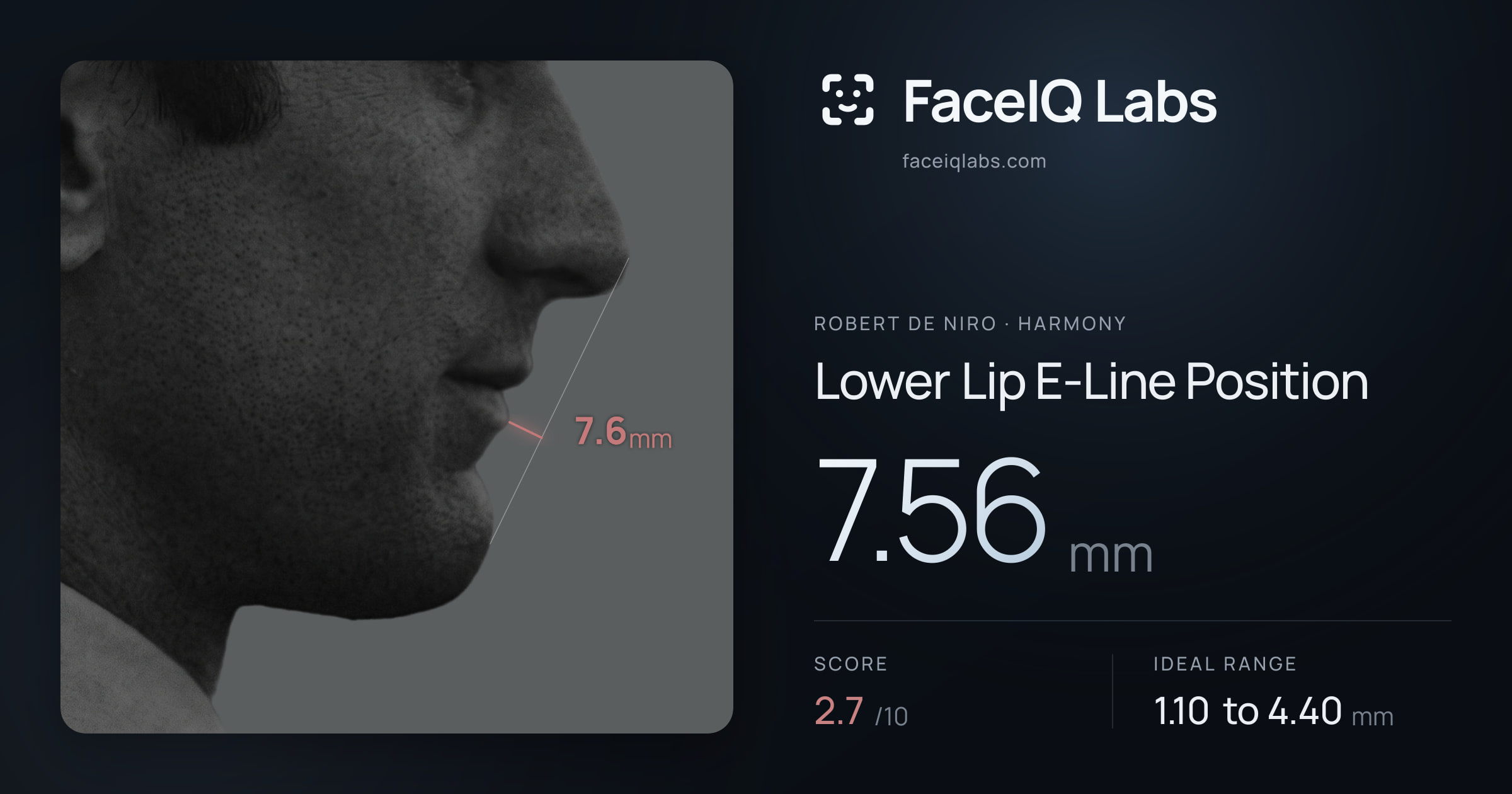 Robert De Niro Lower Lip E-Line Position: 7.56mm, drawn on the photo