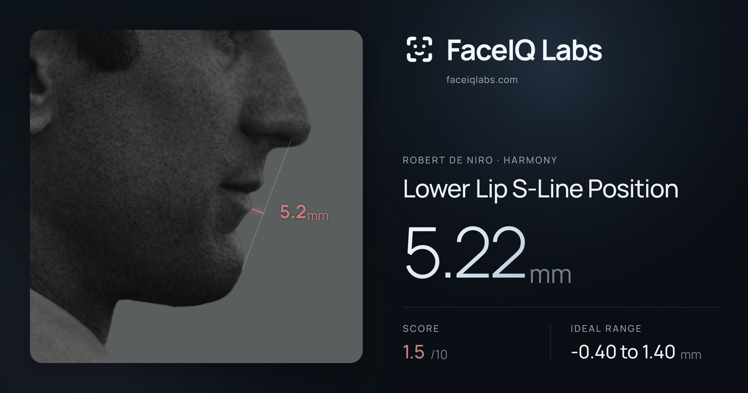 Robert De Niro Lower Lip S-Line Position: 5.22mm, drawn on the photo