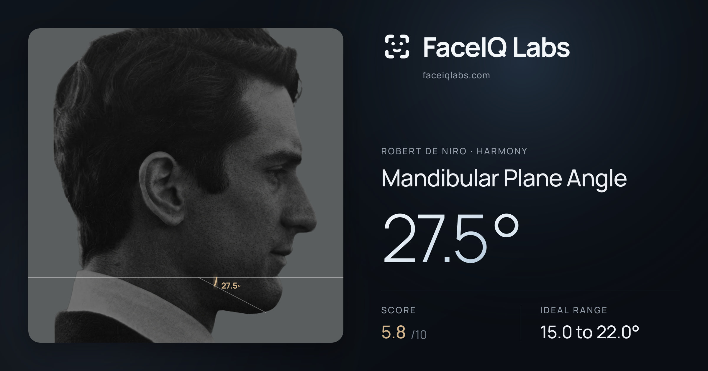 Robert De Niro Mandibular Plane Angle: 27.5°, drawn on the photo