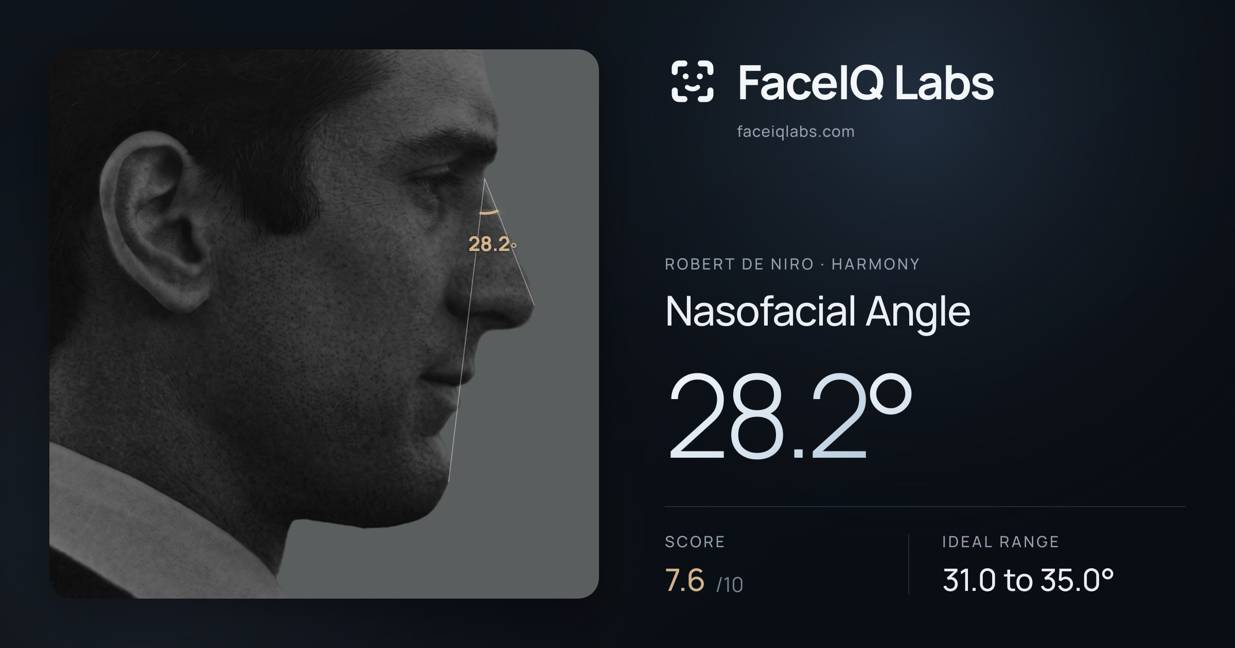 Robert De Niro Nasofacial Angle: 28.2°, drawn on the photo